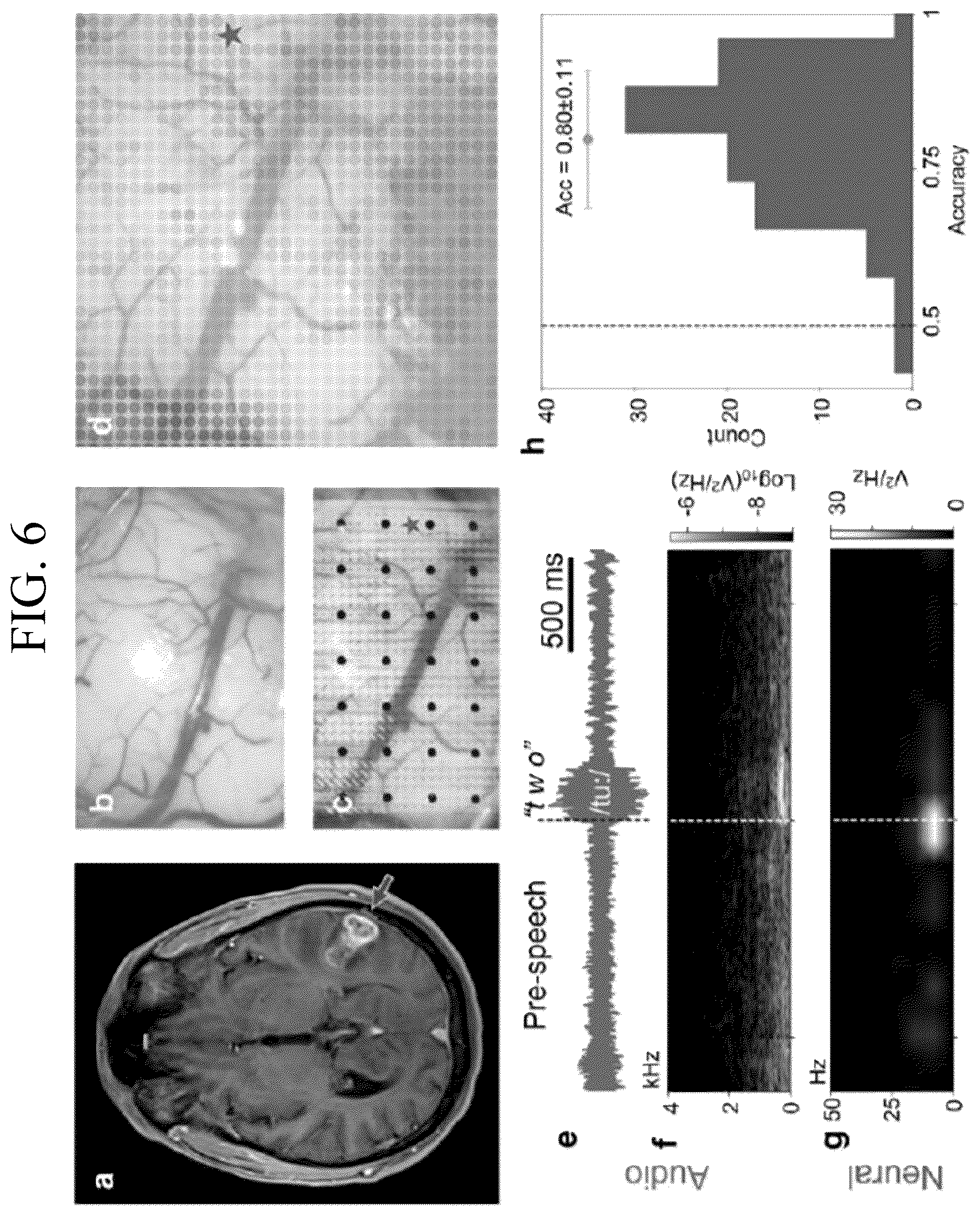 Patent US12611132 Figure 9 – Systems and methods for visualizing brain activity in real time at high spatial and temporal resolution