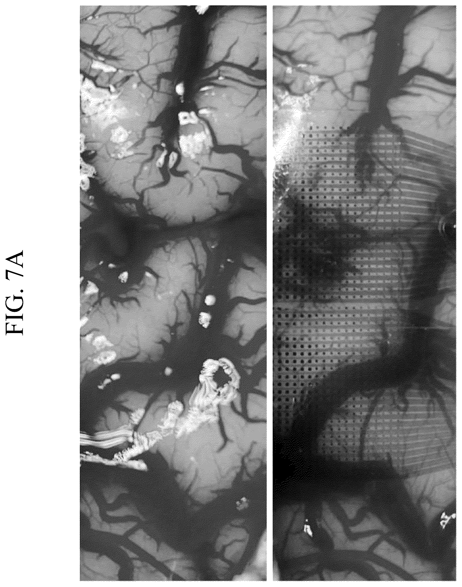 Patent US12611132 Figure 10 – Systems and methods for visualizing brain activity in real time at high spatial and temporal resolution