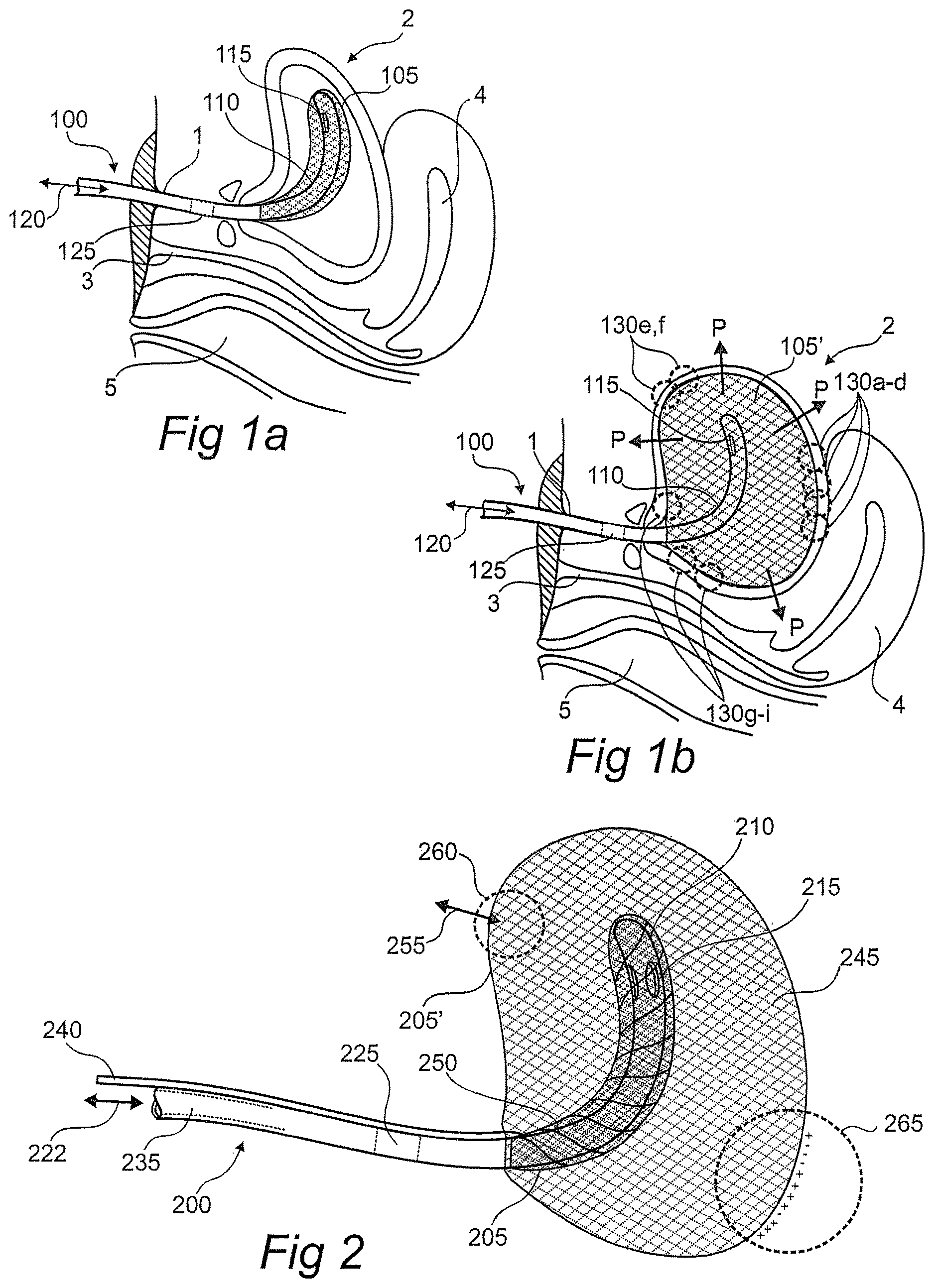 Patent US12611134 Figure 1 – Devices, systems, and methods for diagnosis and treatment of overactive bladder