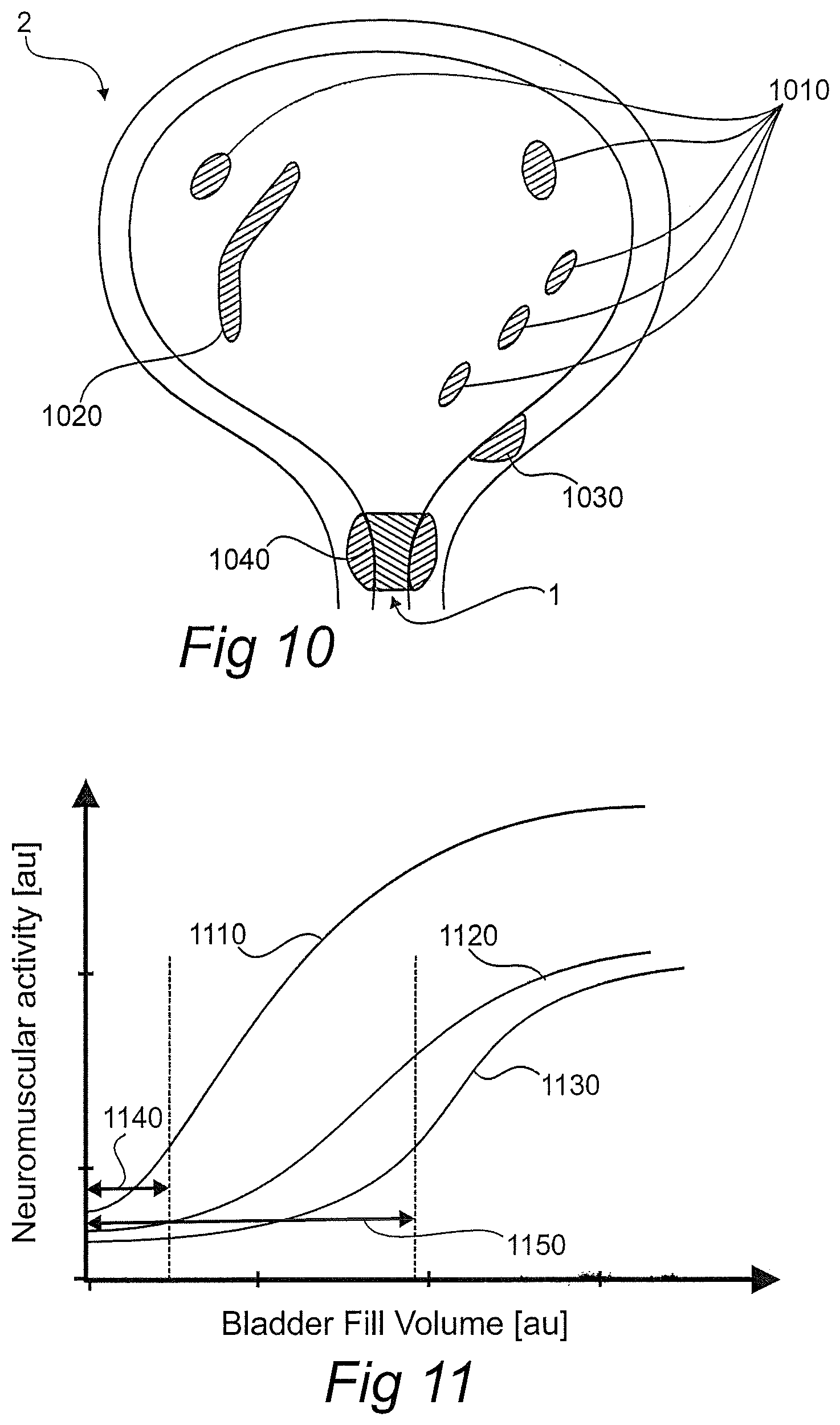 Patent US12611134 Figure 6 – Devices, systems, and methods for diagnosis and treatment of overactive bladder