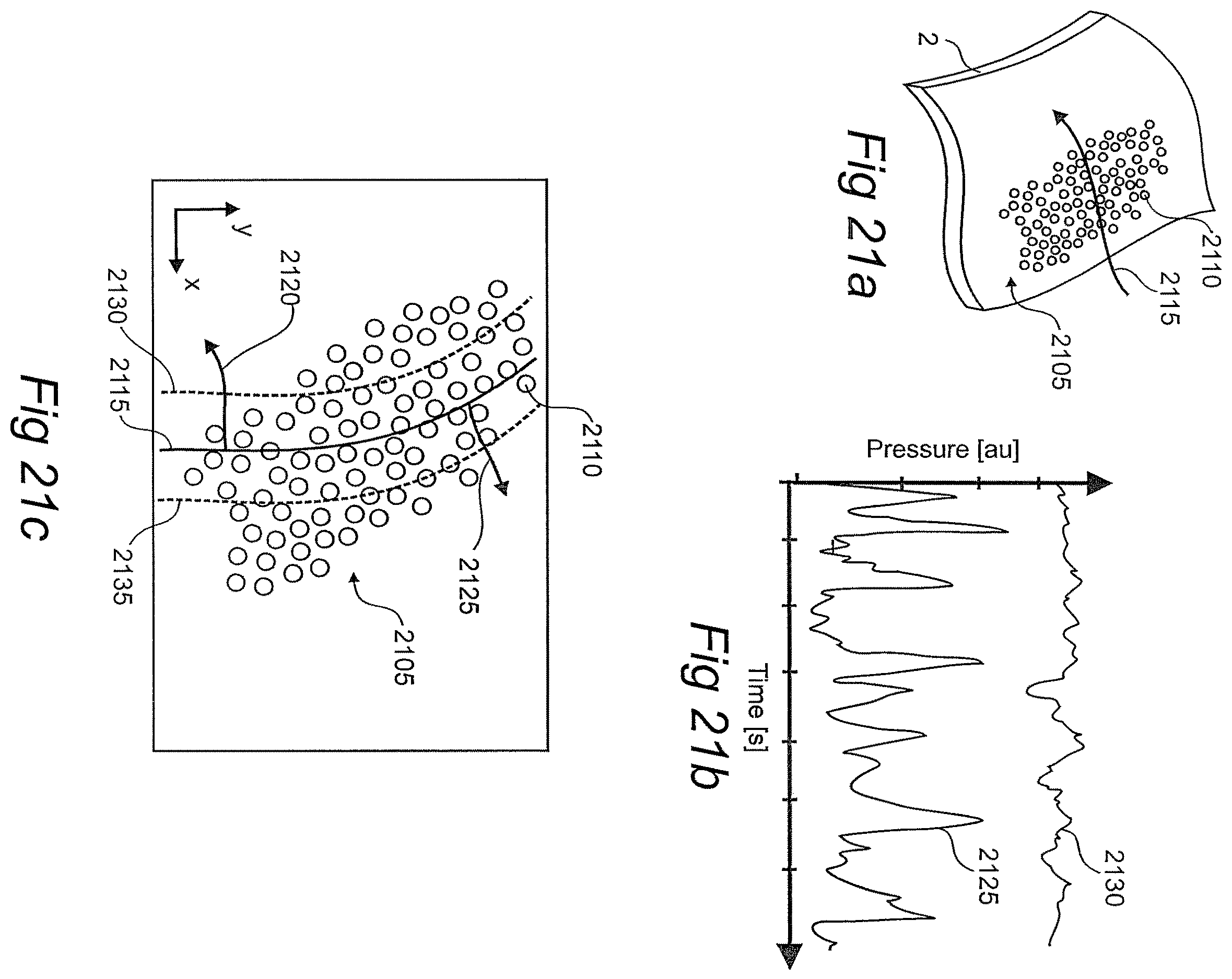 Patent US12611134 Figure 11 – Devices, systems, and methods for diagnosis and treatment of overactive bladder
