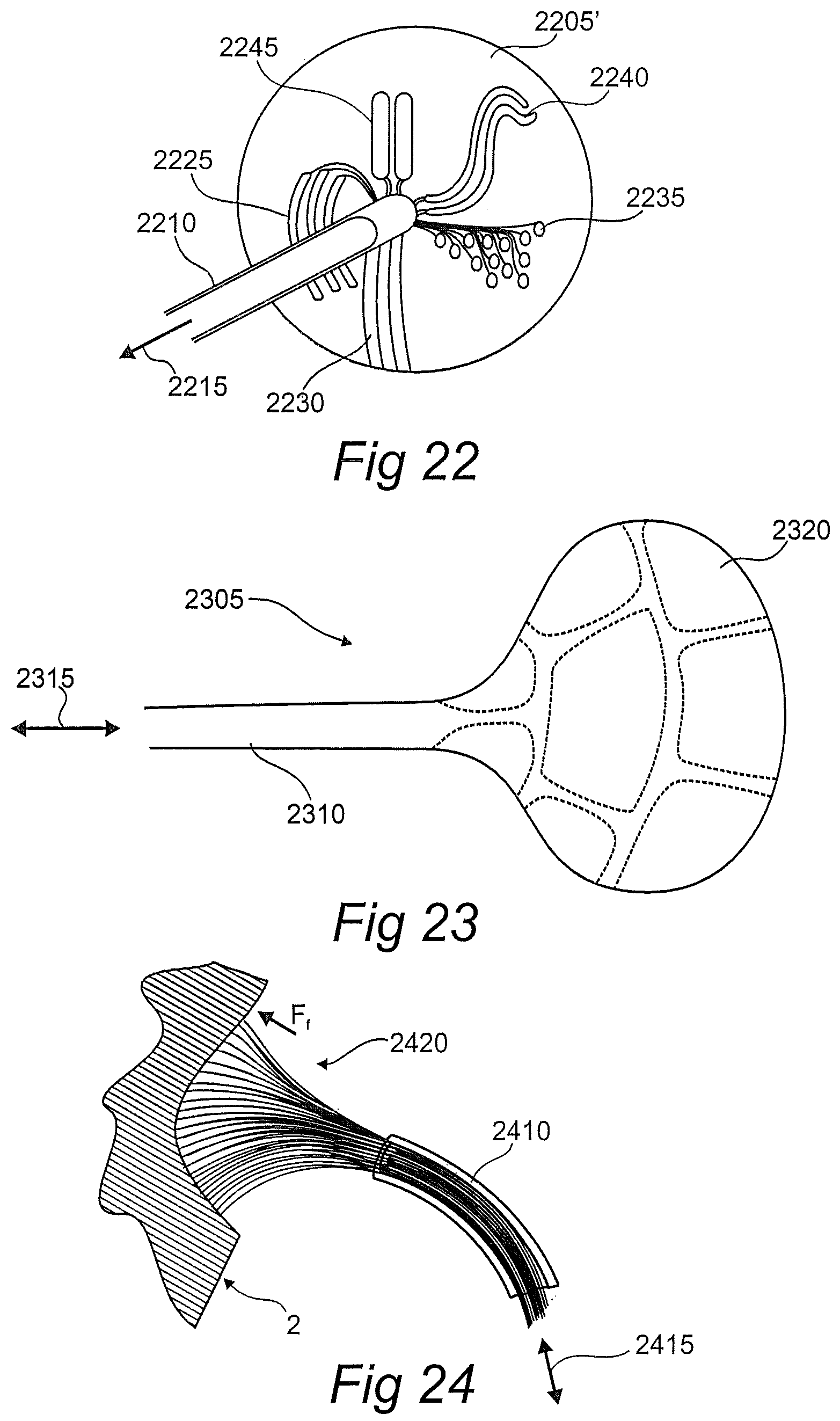 Patent US12611134 Figure 12 – Devices, systems, and methods for diagnosis and treatment of overactive bladder