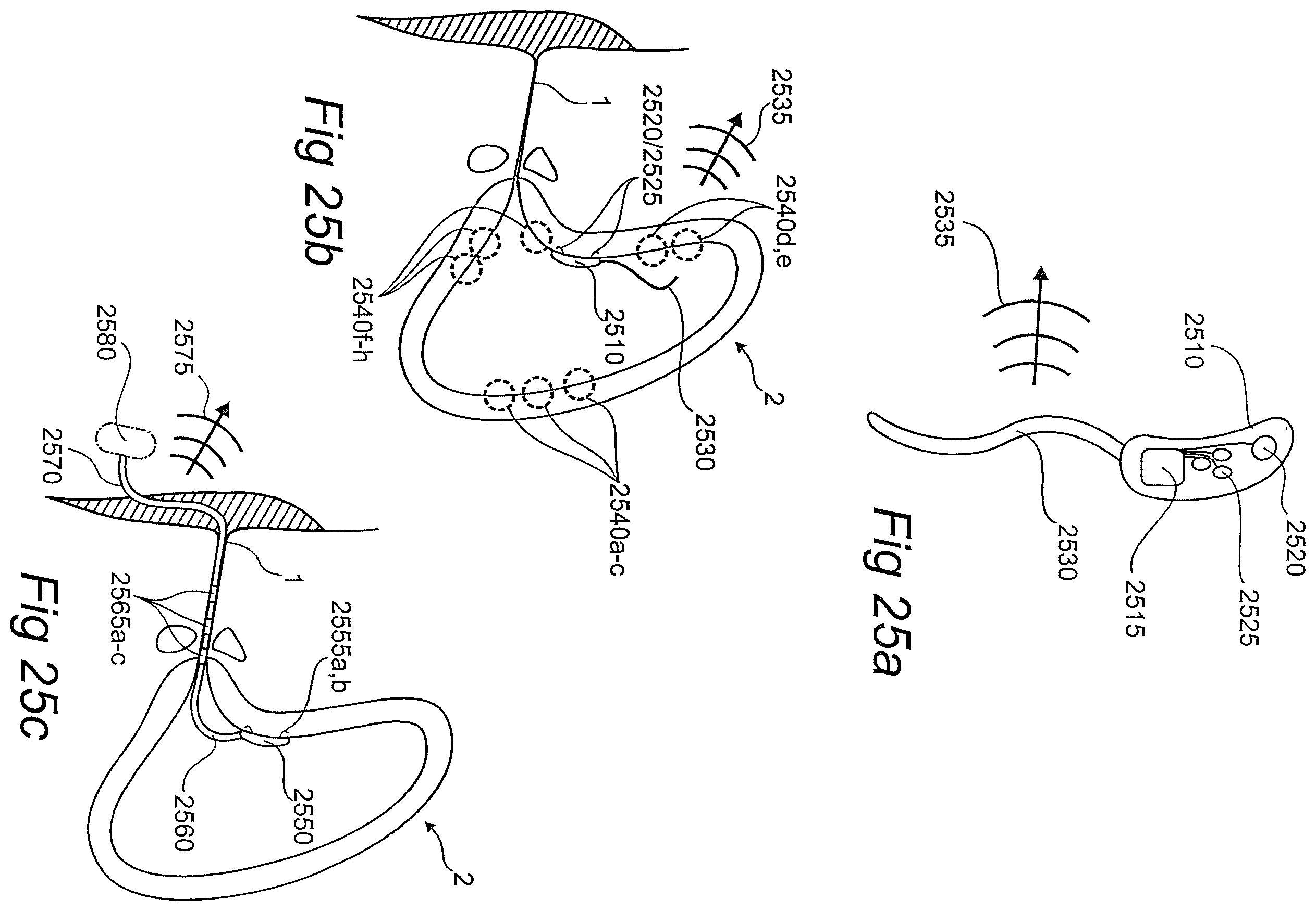 Patent US12611134 Figure 13 – Devices, systems, and methods for diagnosis and treatment of overactive bladder