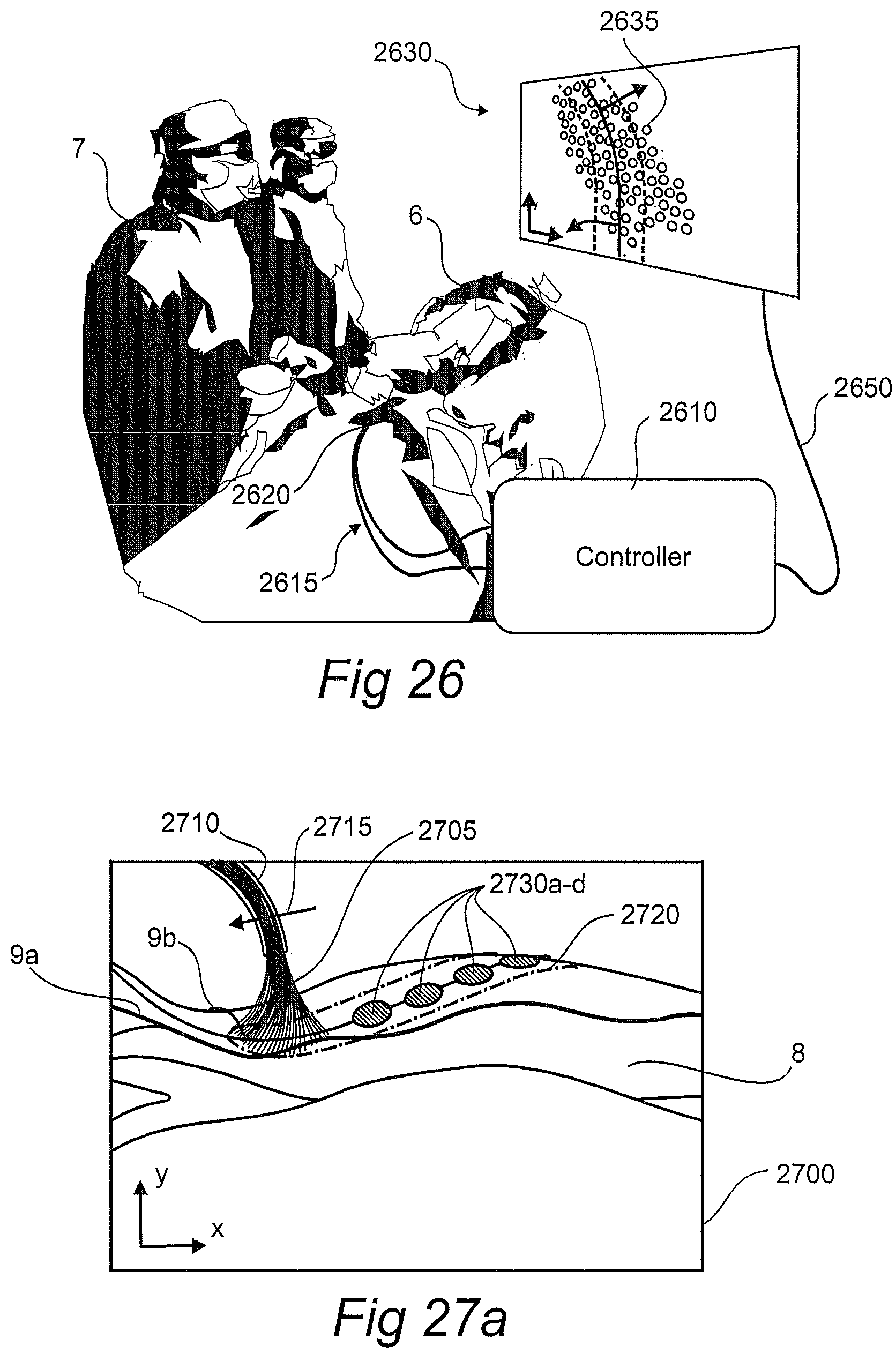 Patent US12611134 Figure 14 – Devices, systems, and methods for diagnosis and treatment of overactive bladder