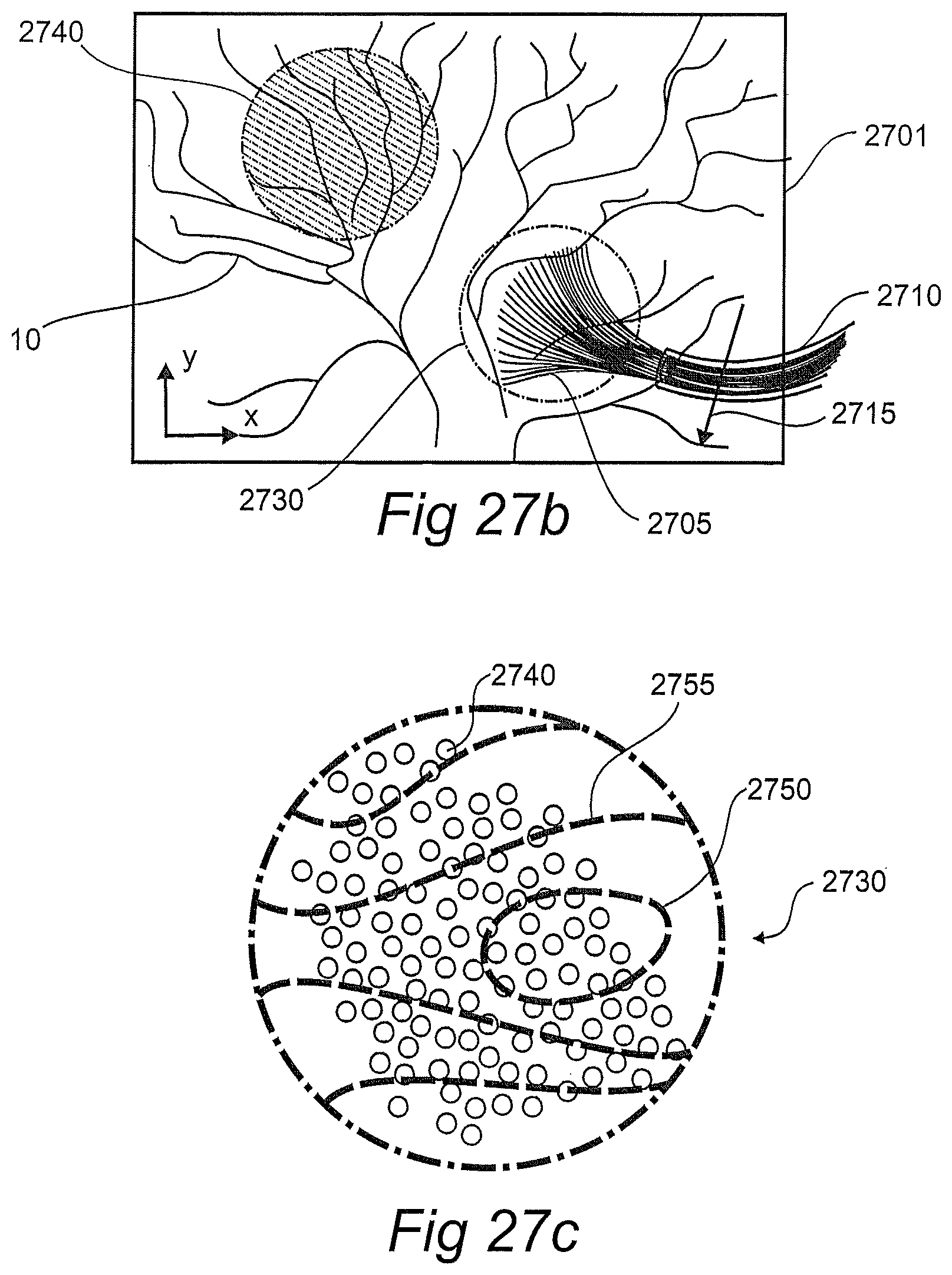 Patent US12611134 Figure 15 – Devices, systems, and methods for diagnosis and treatment of overactive bladder