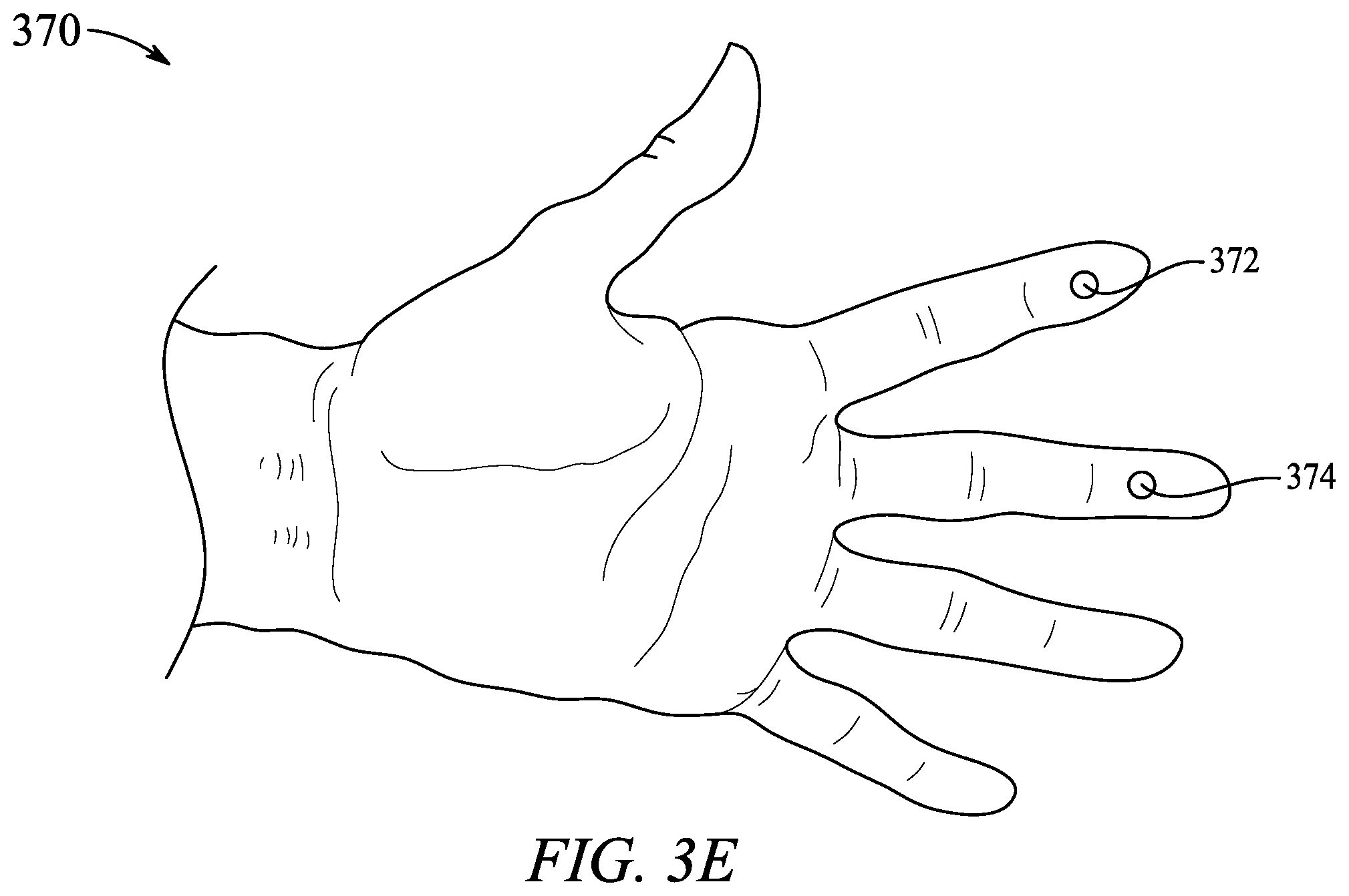 Patent US12611136 Figure 15 – Epi-seizure device for the prediction and detection of tonic-clonic seizures