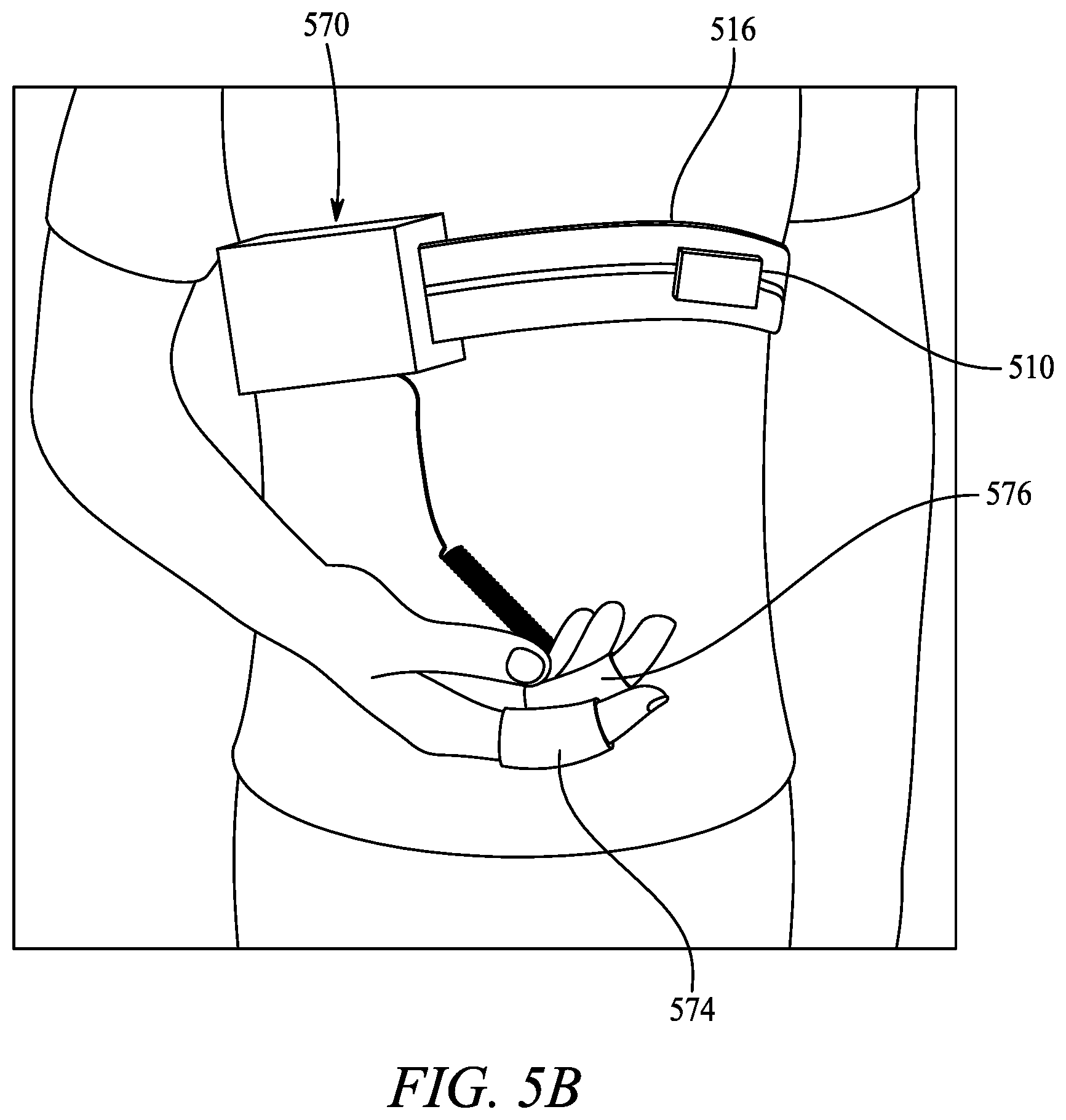 Patent US12611136 Figure 20 – Epi-seizure device for the prediction and detection of tonic-clonic seizures