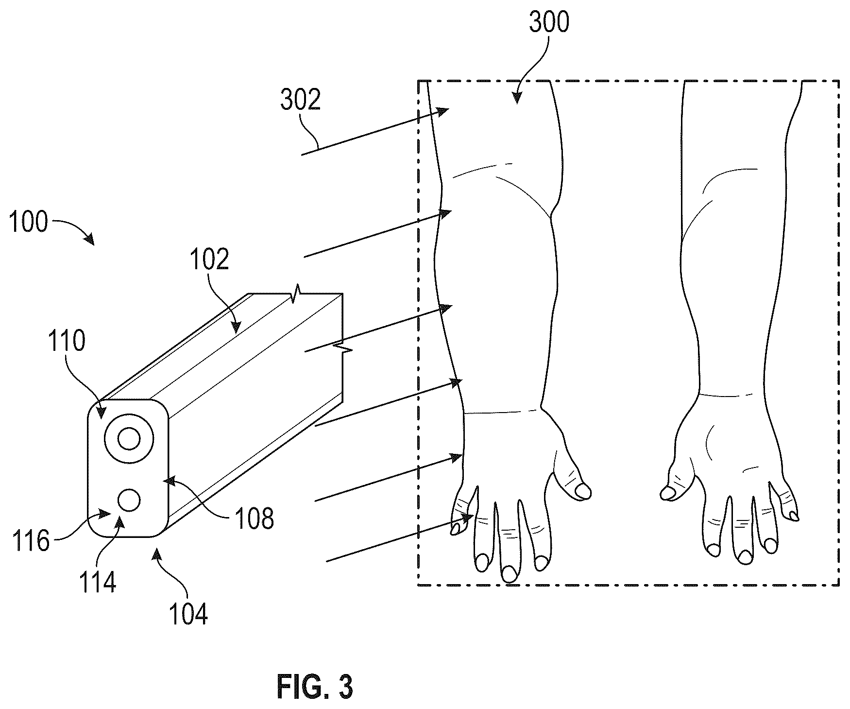 Patent US12611137 Figure 3 – Lymphatic diagnostic device