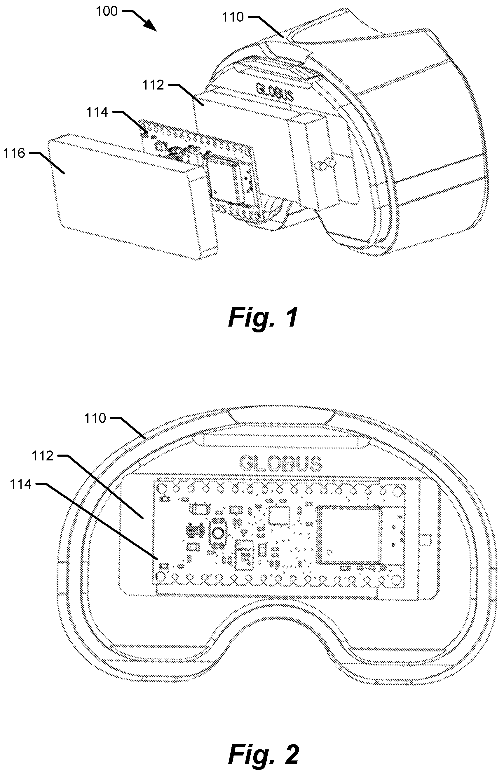Patent US12611140 Figure 1 – Medical implants with circuits treating periprosthetic joint infection and other sensing
