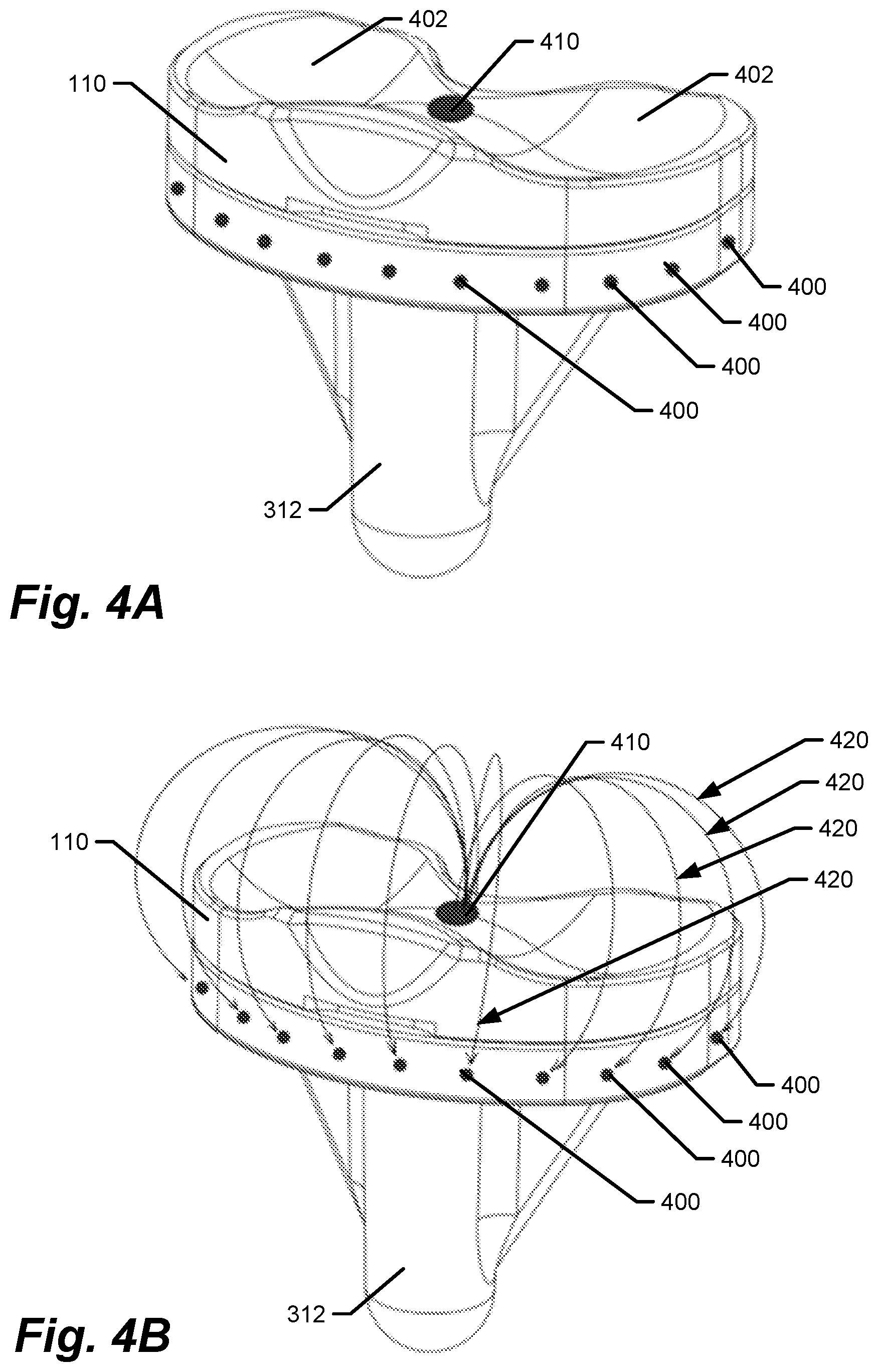Patent US12611140 Figure 3 – Medical implants with circuits treating periprosthetic joint infection and other sensing
