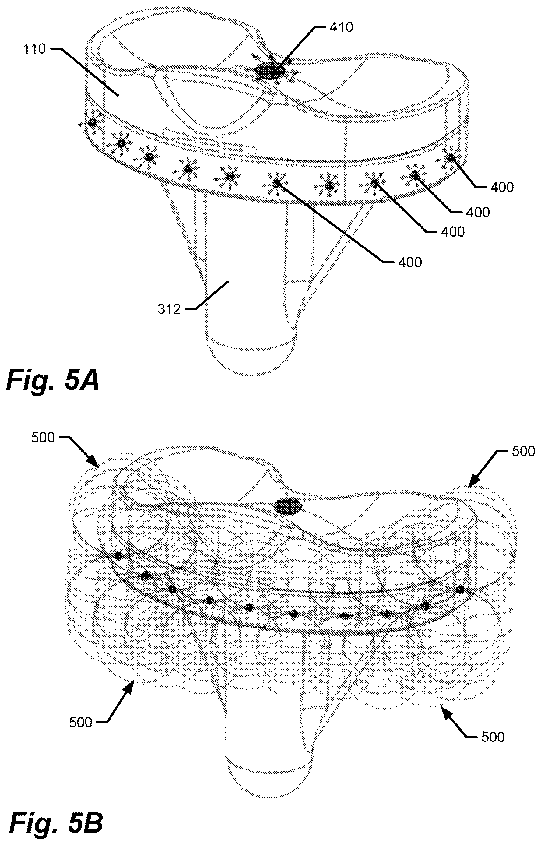 Patent US12611140 Figure 4 – Medical implants with circuits treating periprosthetic joint infection and other sensing