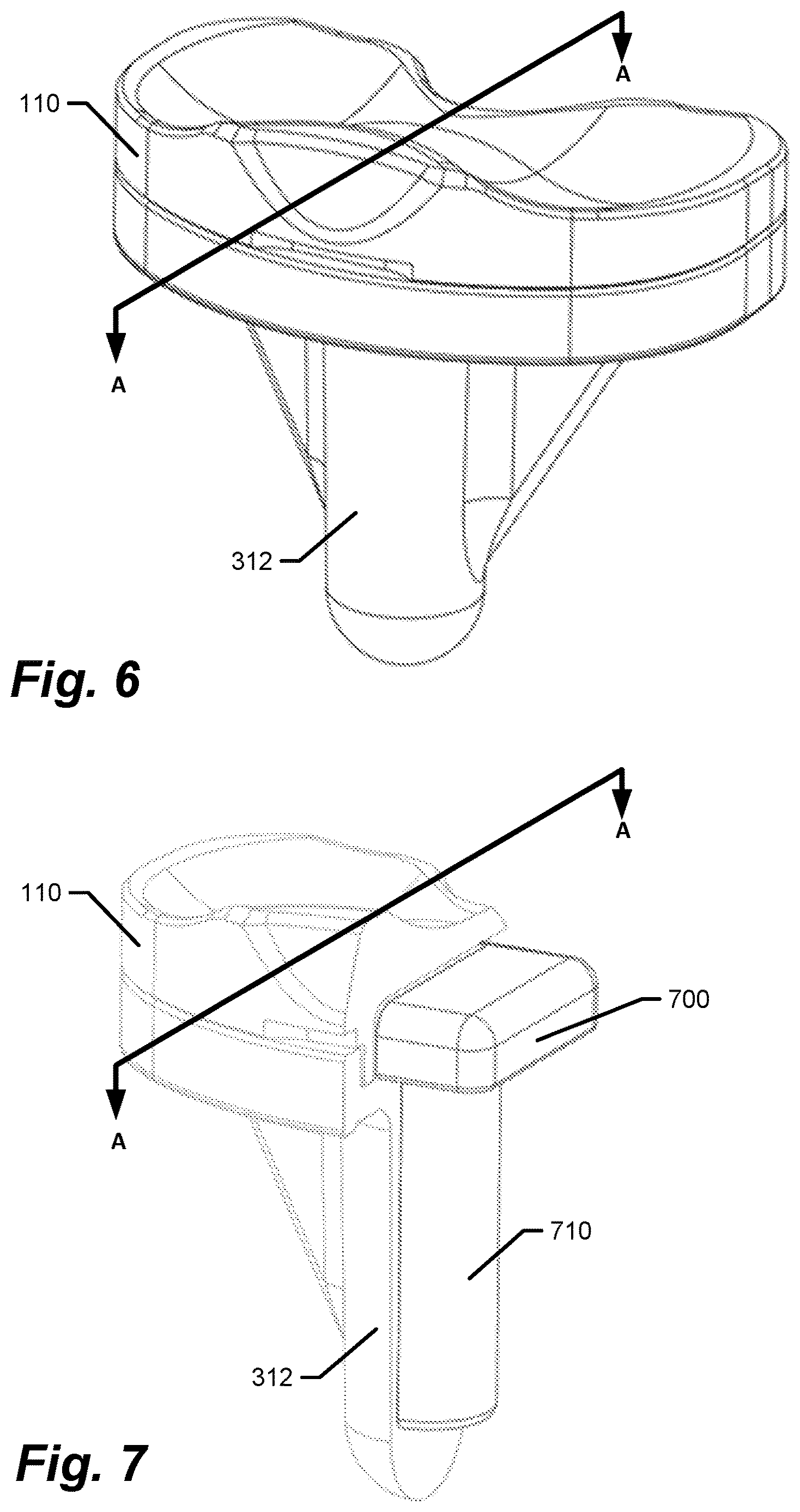 Patent US12611140 Figure 5 – Medical implants with circuits treating periprosthetic joint infection and other sensing