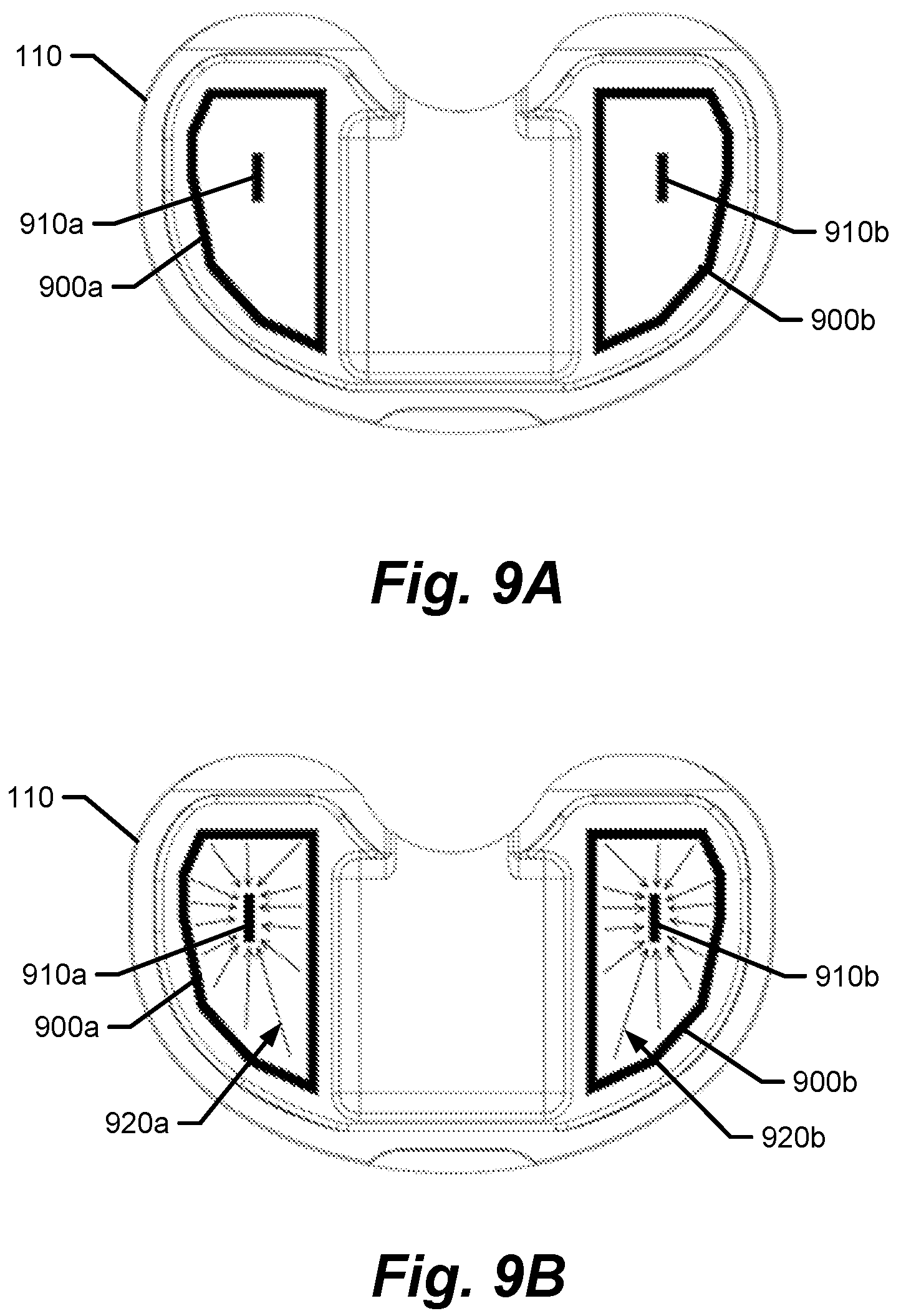 Patent US12611140 Figure 7 – Medical implants with circuits treating periprosthetic joint infection and other sensing