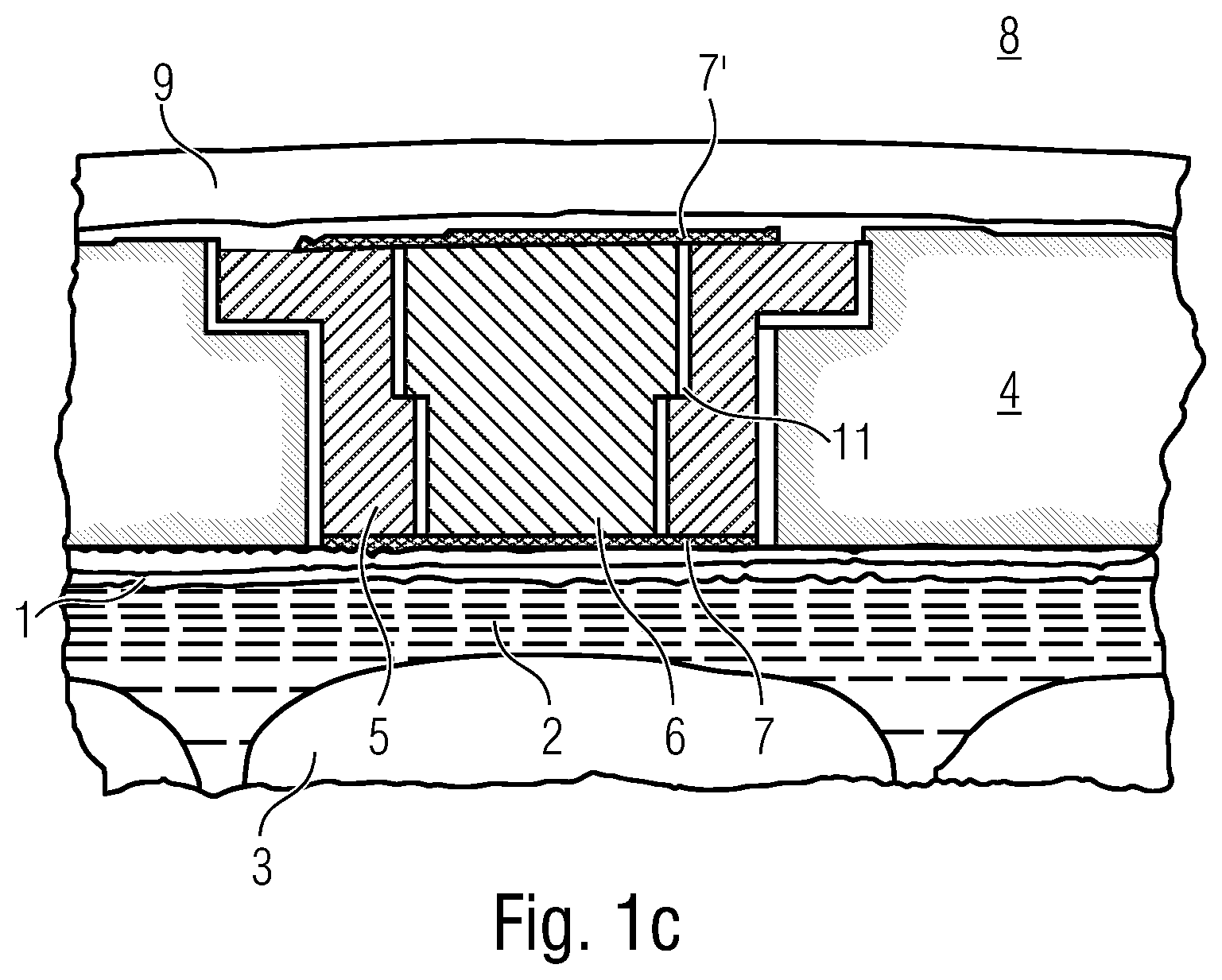 Patent US12611144 Figure 3 – Implant