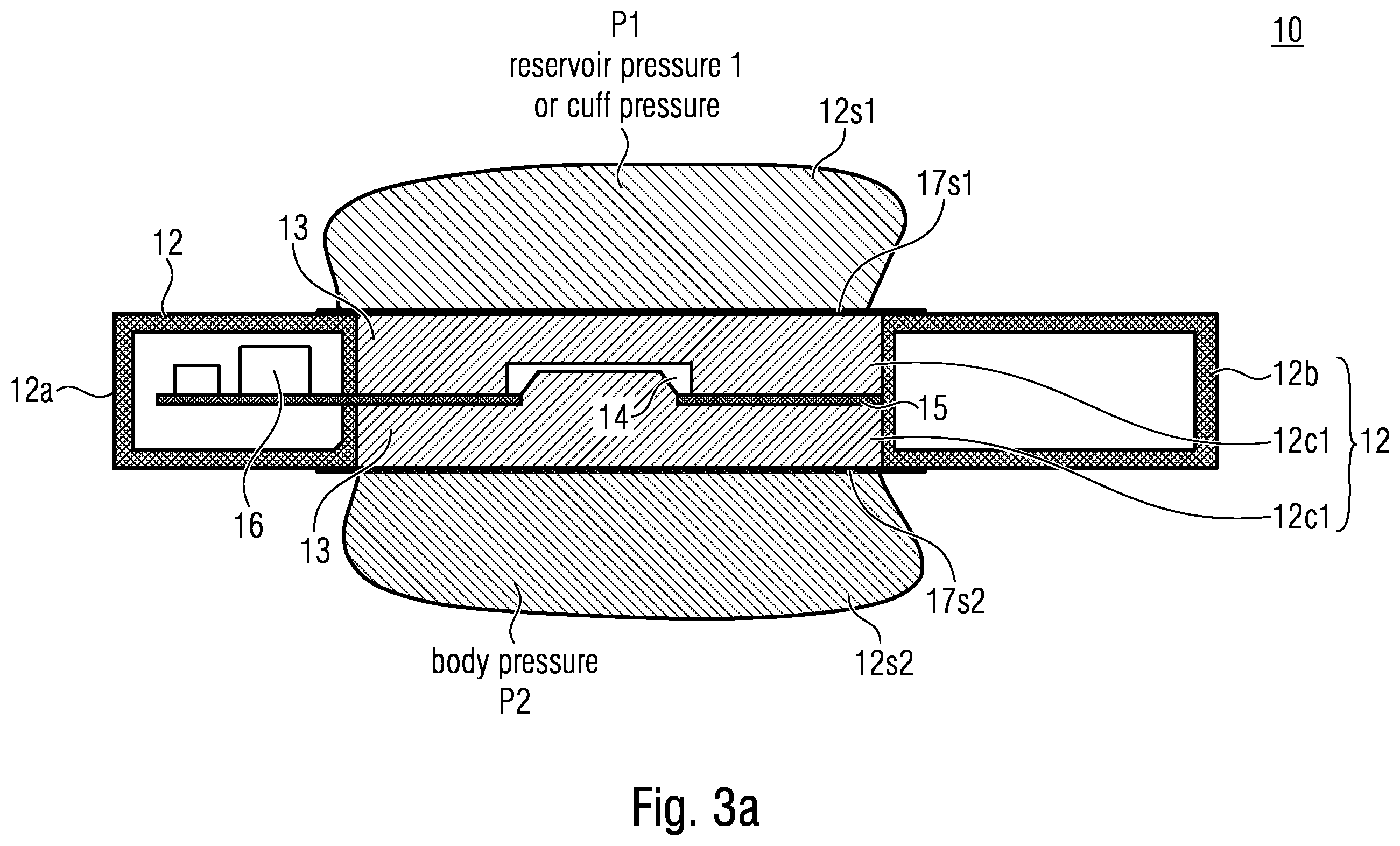 Patent US12611144 Figure 6 – Implant