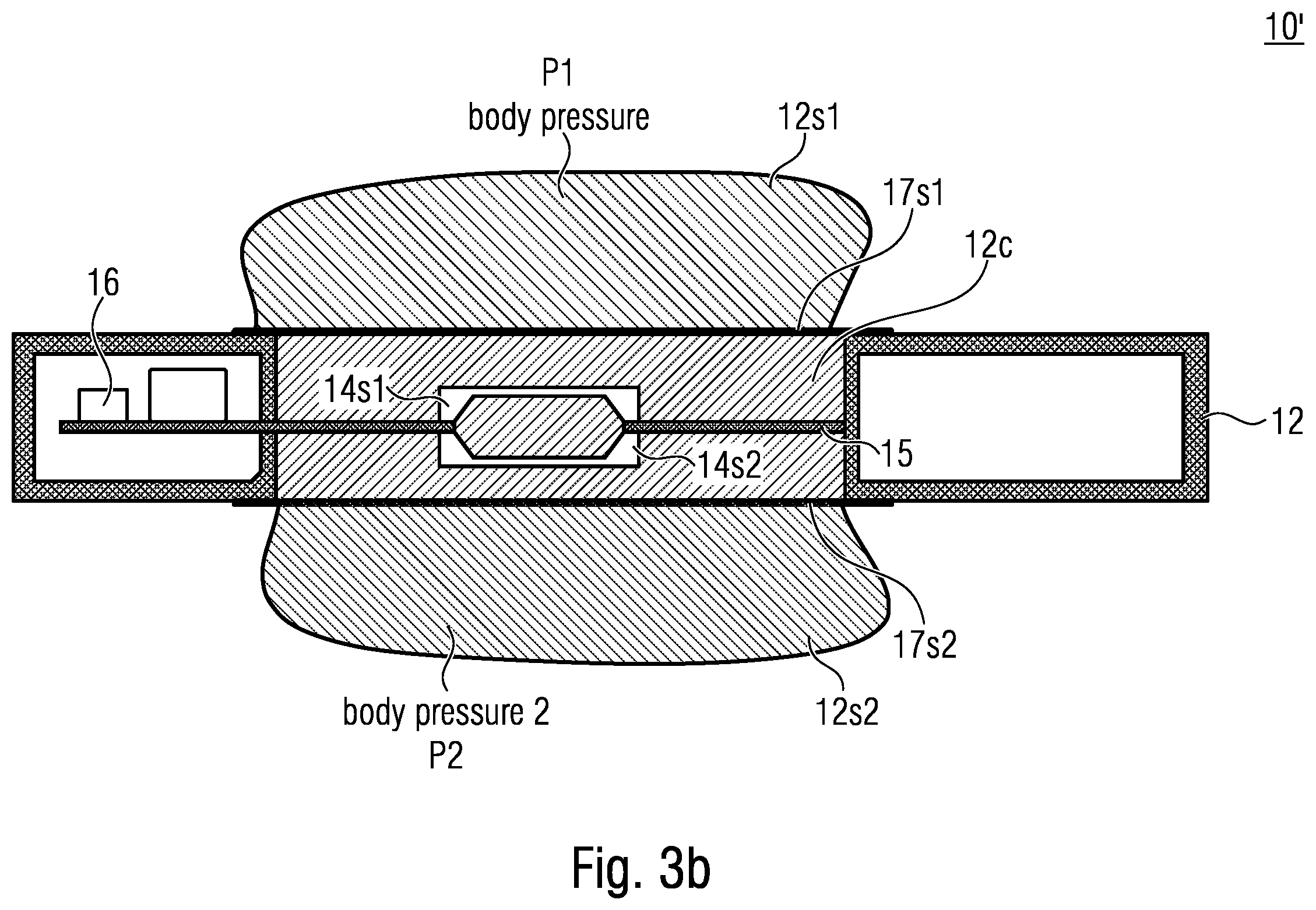 Patent US12611144 Figure 7 – Implant
