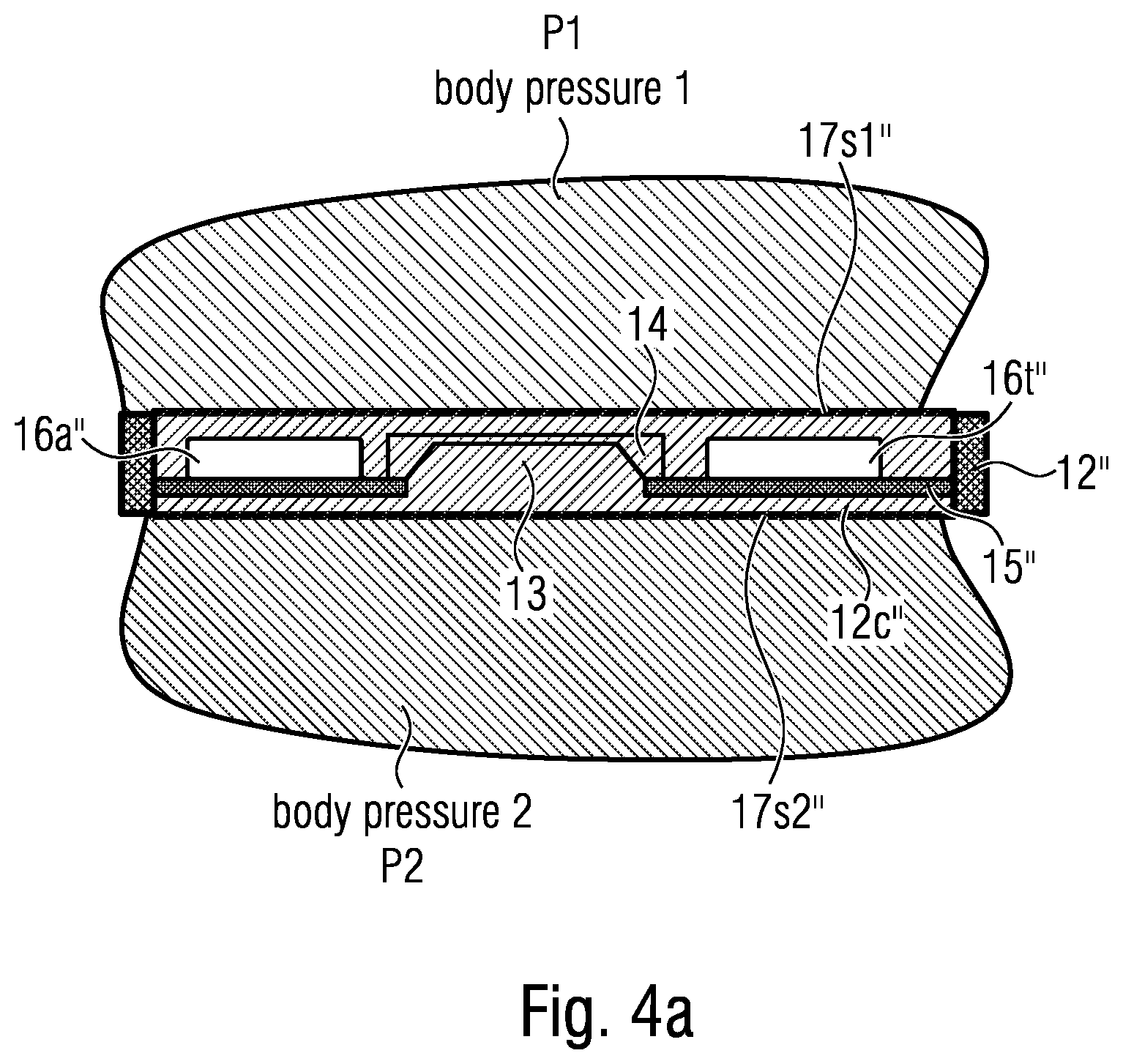 Patent US12611144 Figure 8 – Implant