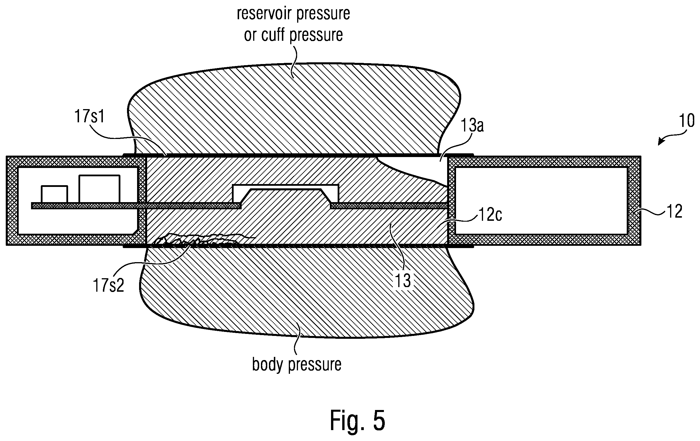 Patent US12611144 Figure 10 – Implant