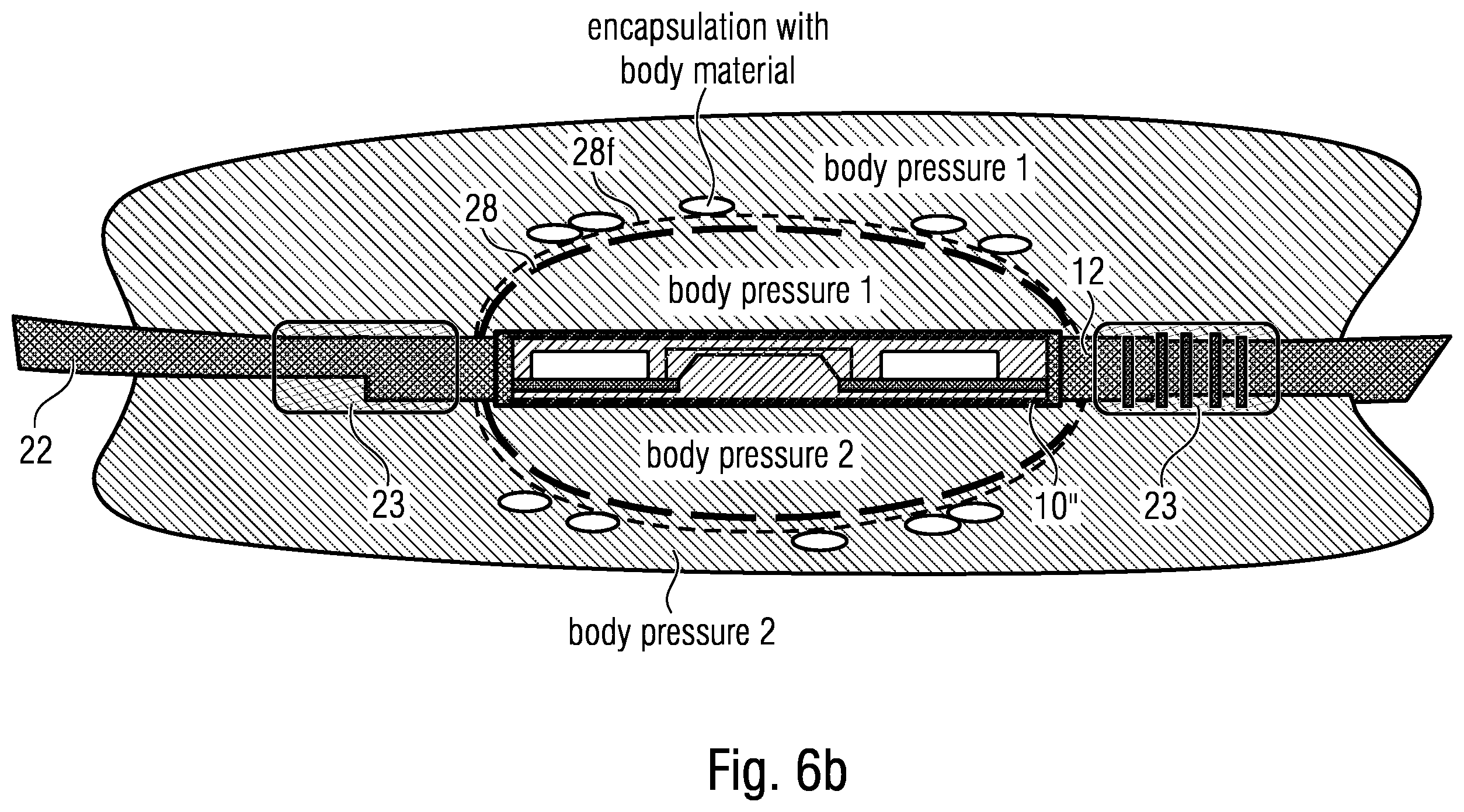 Patent US12611144 Figure 12 – Implant
