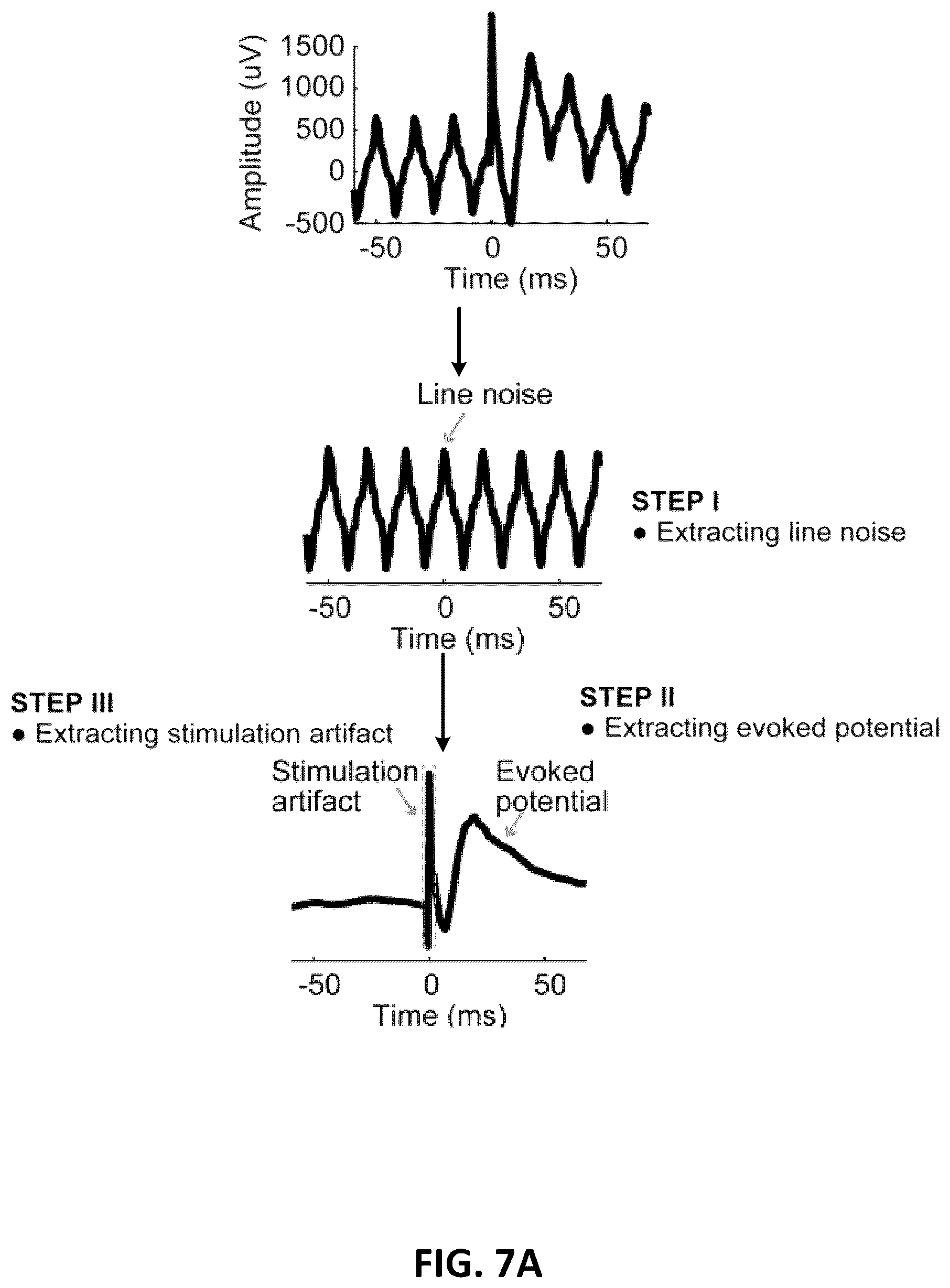 Patent US12611146 Figure 11 – Systems and methods to remove brain stimulation artifacts in neural signals