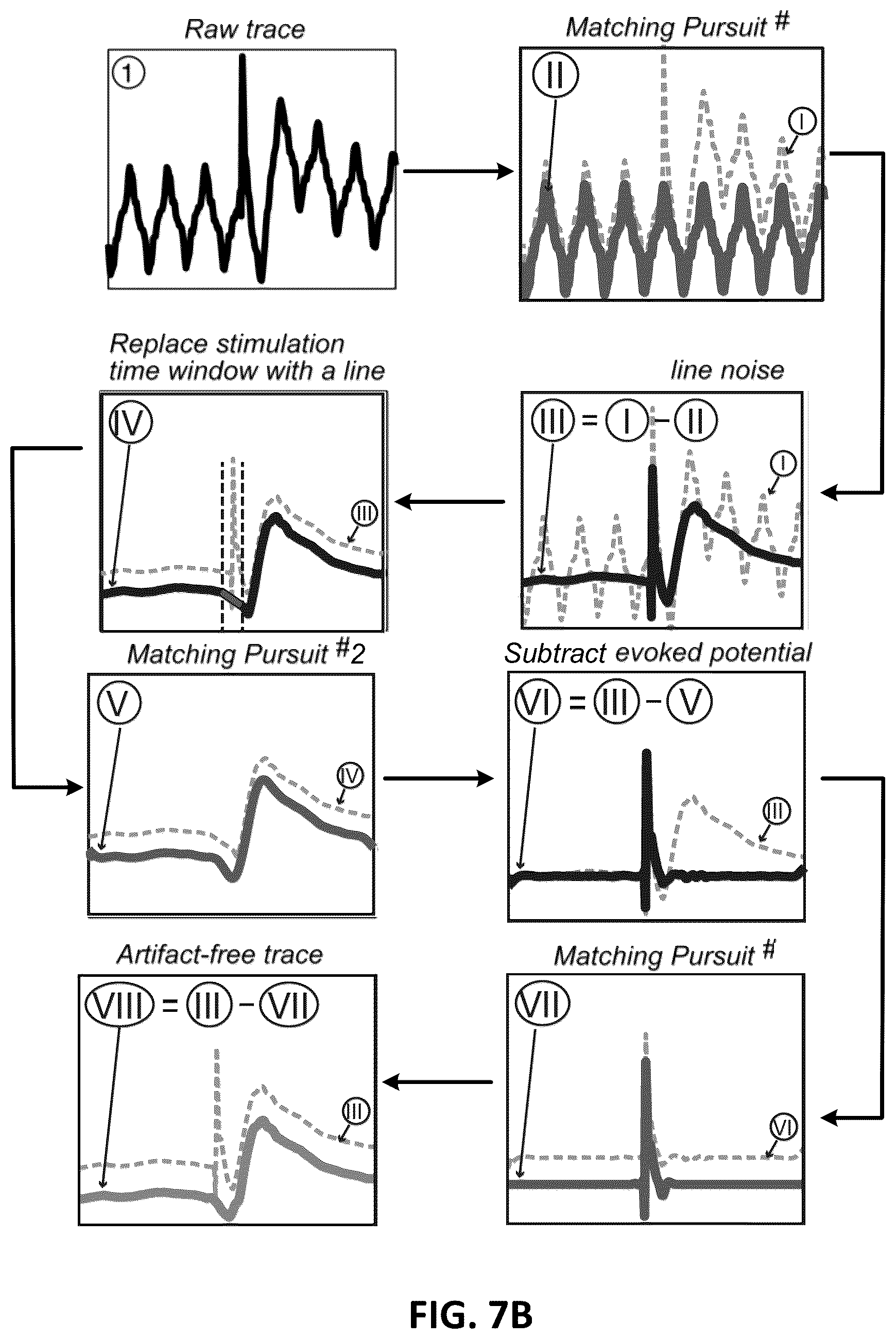 Patent US12611146 Figure 12 – Systems and methods to remove brain stimulation artifacts in neural signals