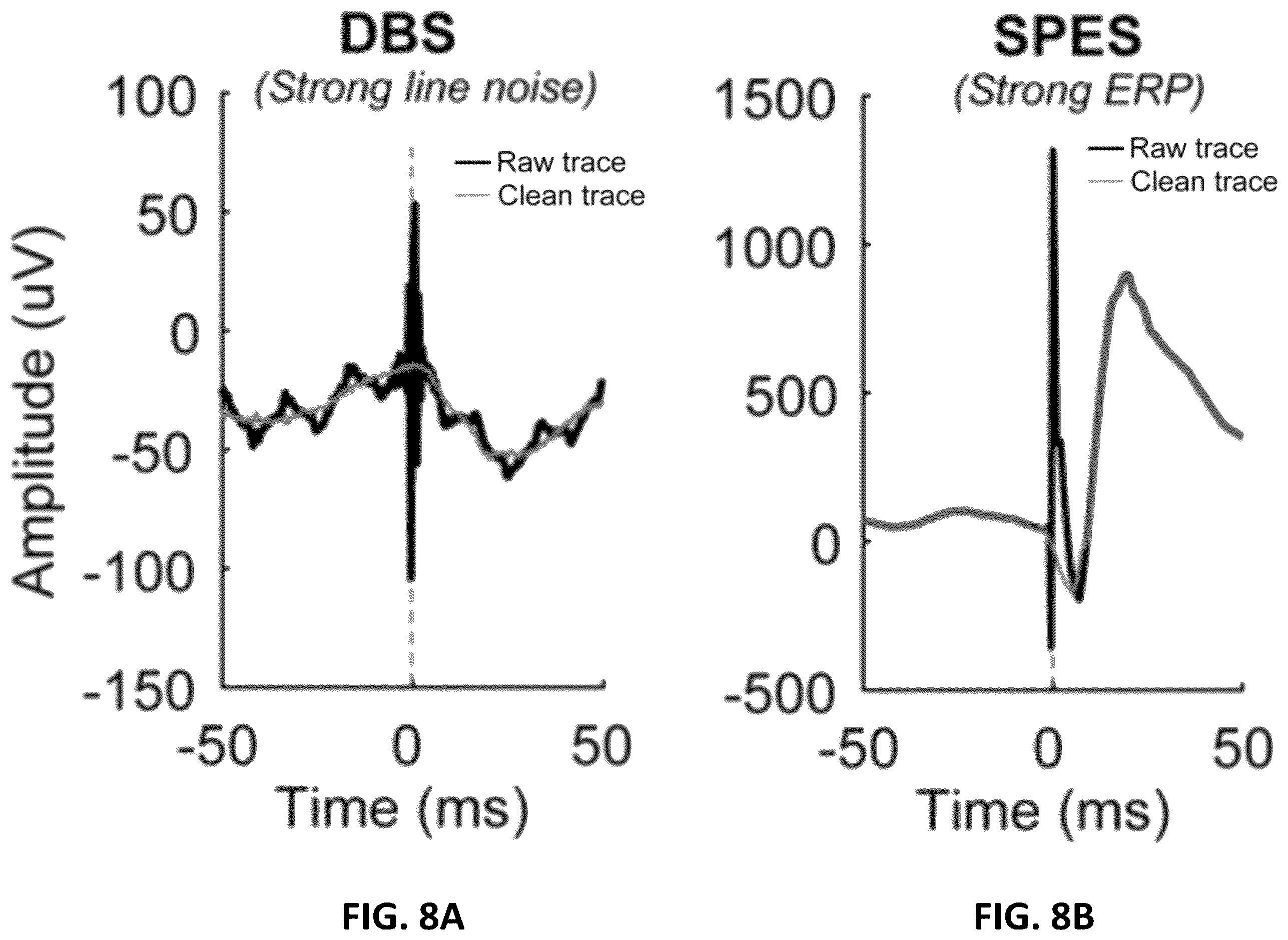 Patent US12611146 Figure 13 – Systems and methods to remove brain stimulation artifacts in neural signals