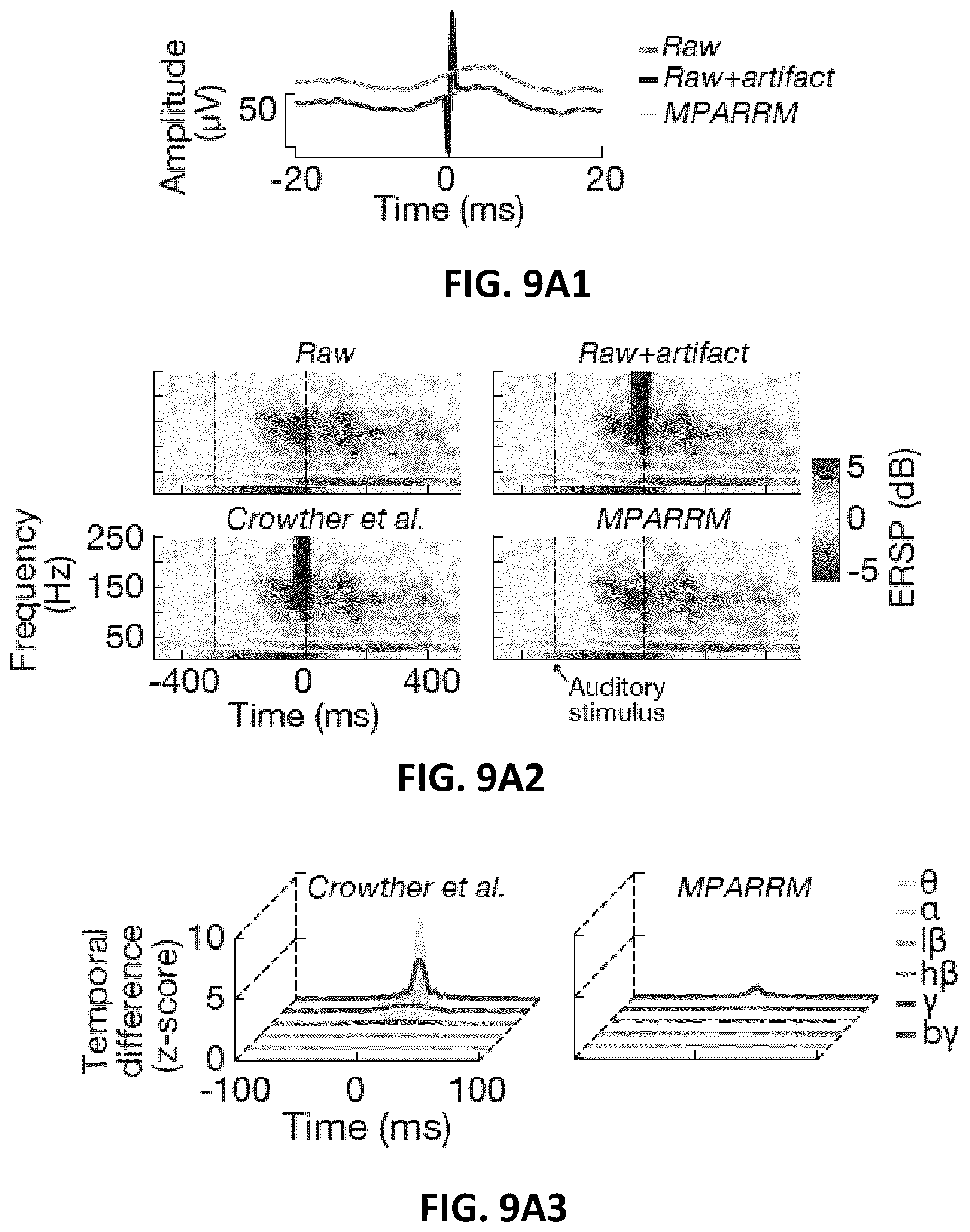Patent US12611146 Figure 16 – Systems and methods to remove brain stimulation artifacts in neural signals