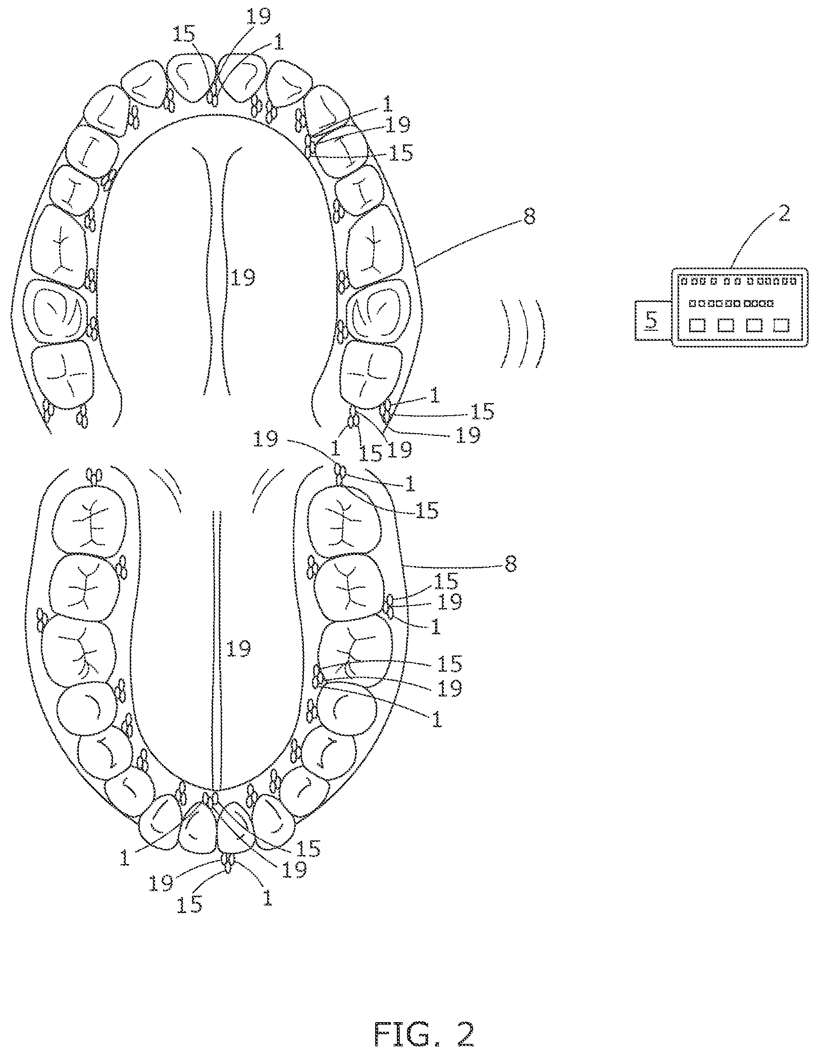 Patent US12611147 Figure 2 – Devices to inform healthcare workers of pain, data science and artificial intelligence-related methods and systems to understand pain