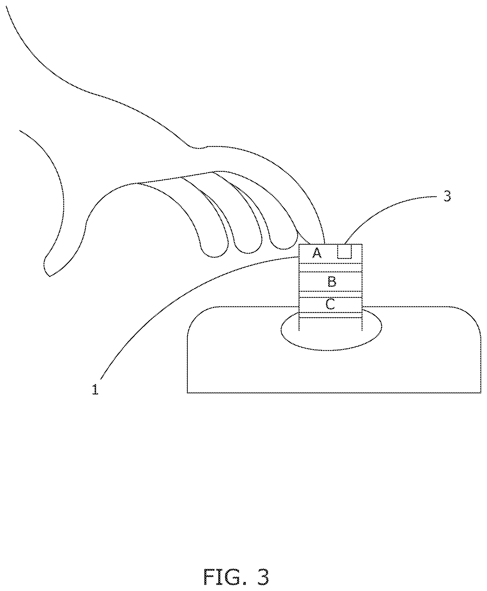 Patent US12611147 Figure 3 – Devices to inform healthcare workers of pain, data science and artificial intelligence-related methods and systems to understand pain