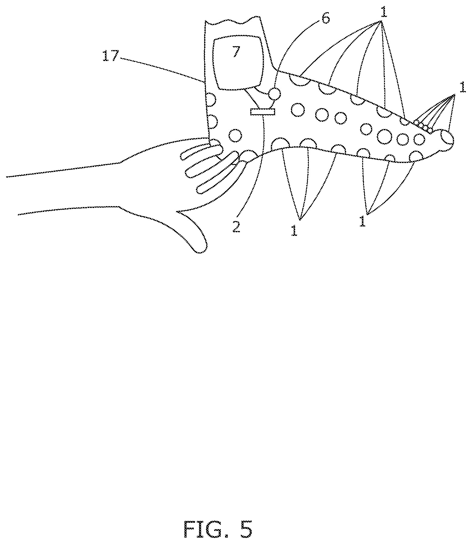 Patent US12611147 Figure 5 – Devices to inform healthcare workers of pain, data science and artificial intelligence-related methods and systems to understand pain