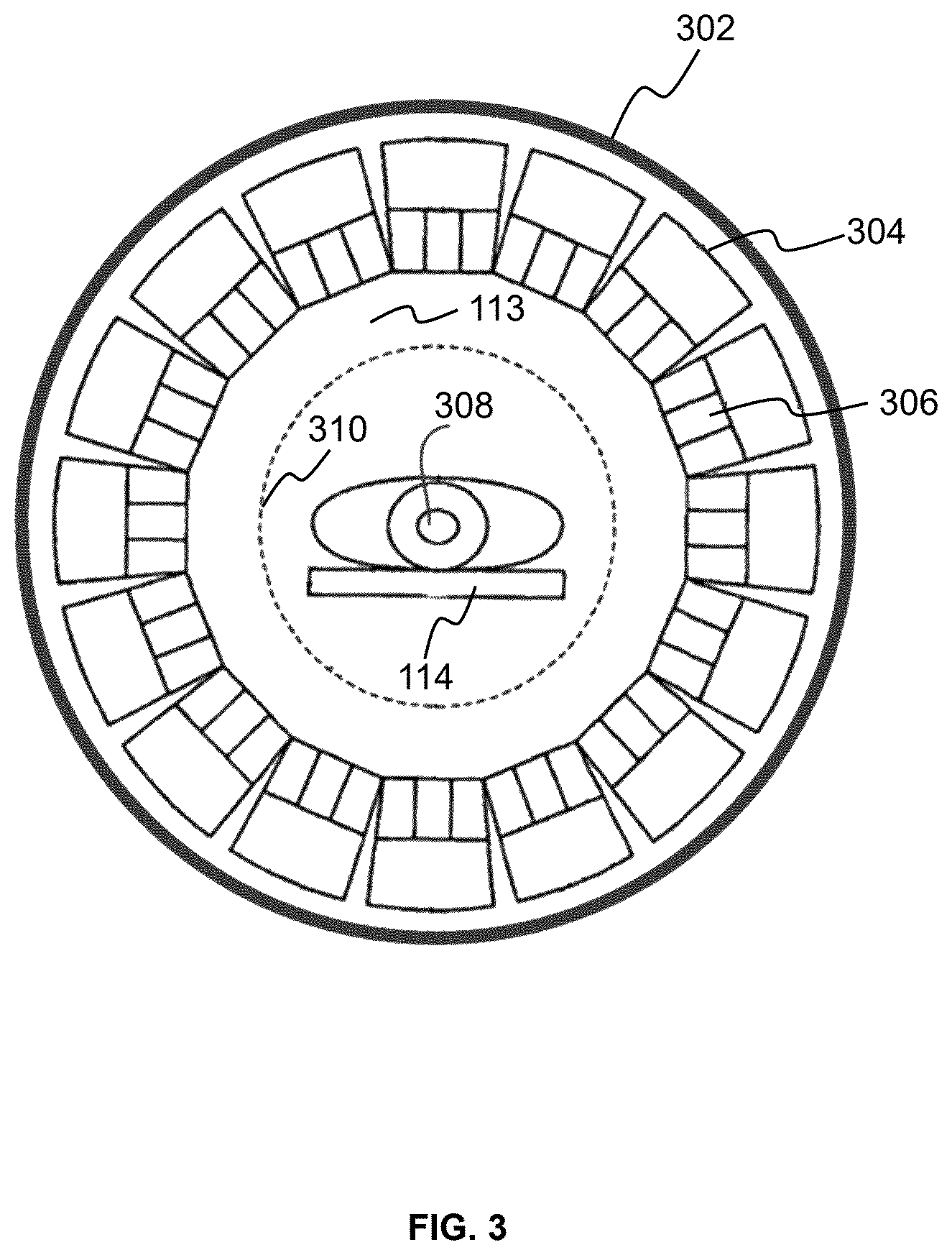 Patent US12611151 Figure 3 – System and method for PET imaging