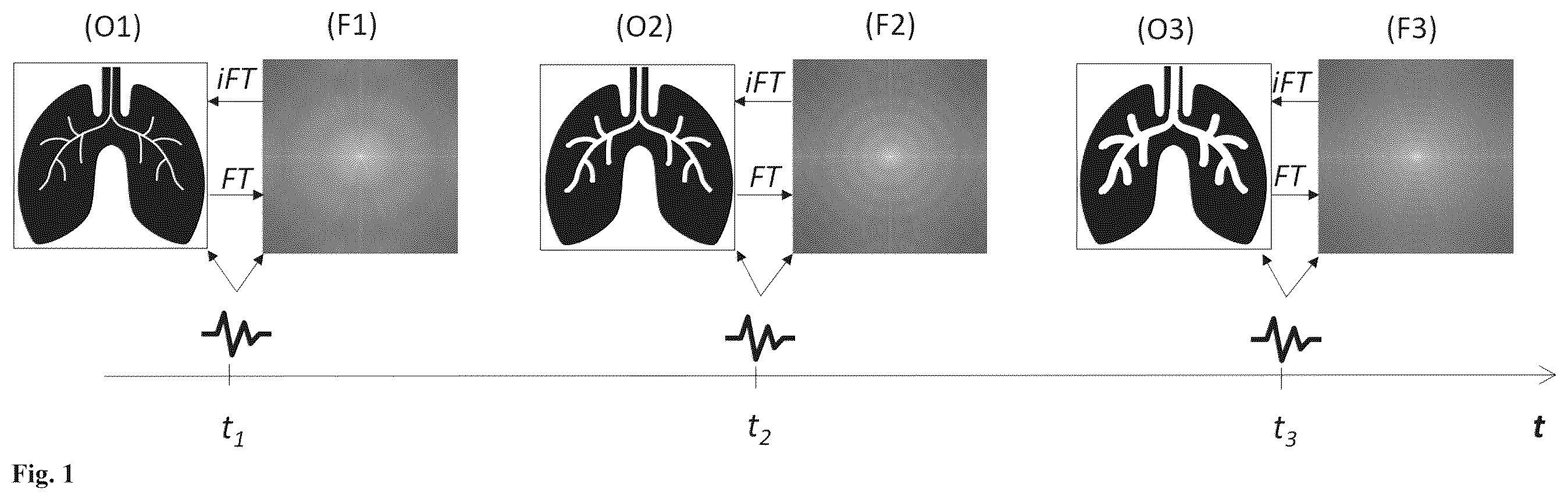 Patent US12611152 Figure 1 – Machine learning in the field of contrast-enhanced radiology