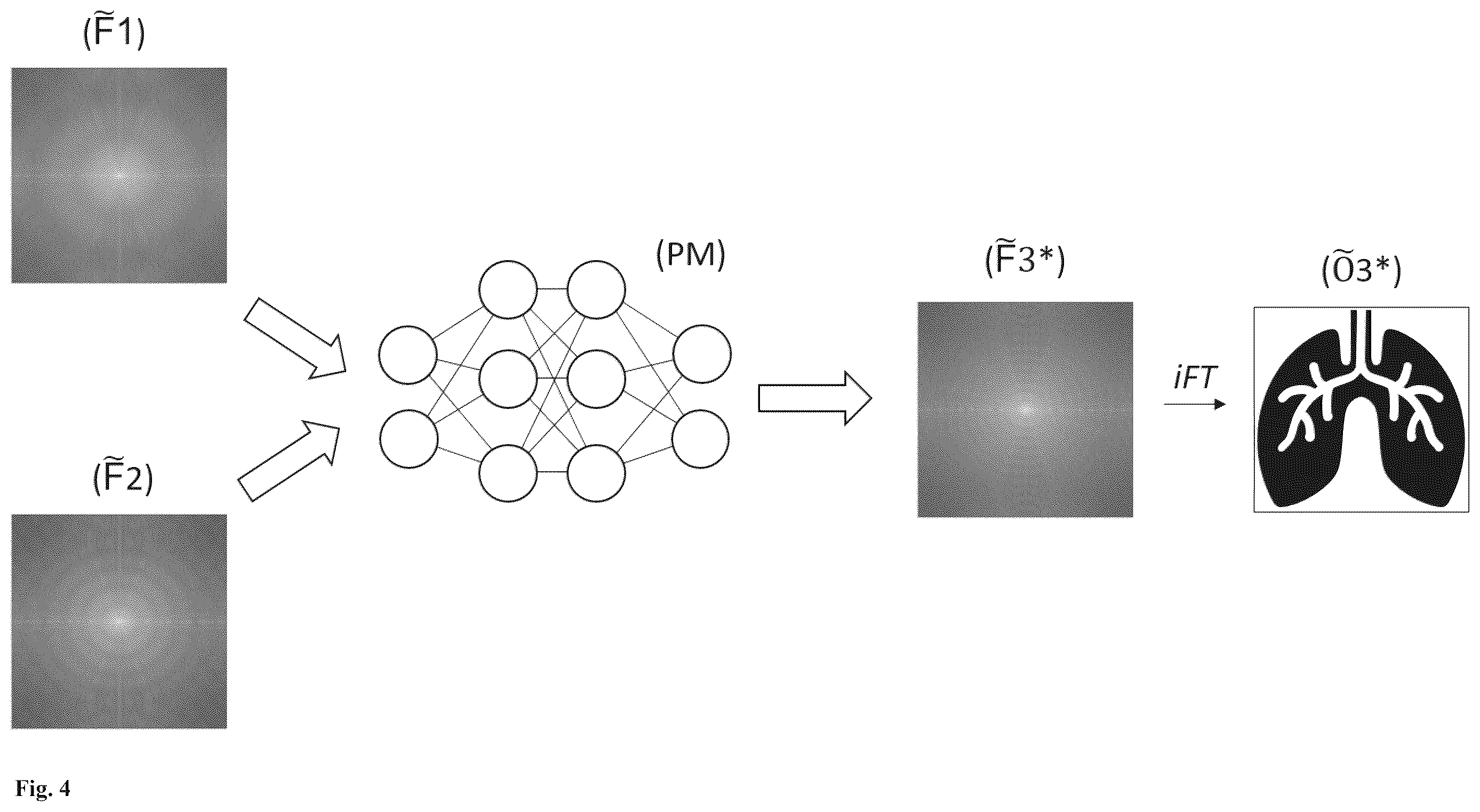 Patent US12611152 Figure 4 – Machine learning in the field of contrast-enhanced radiology