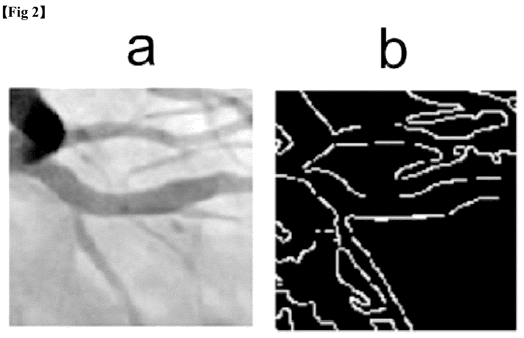Patent US12611155 Figure 2 – Method for providing information necessary for evaluating severity of coronary artery stenosis
