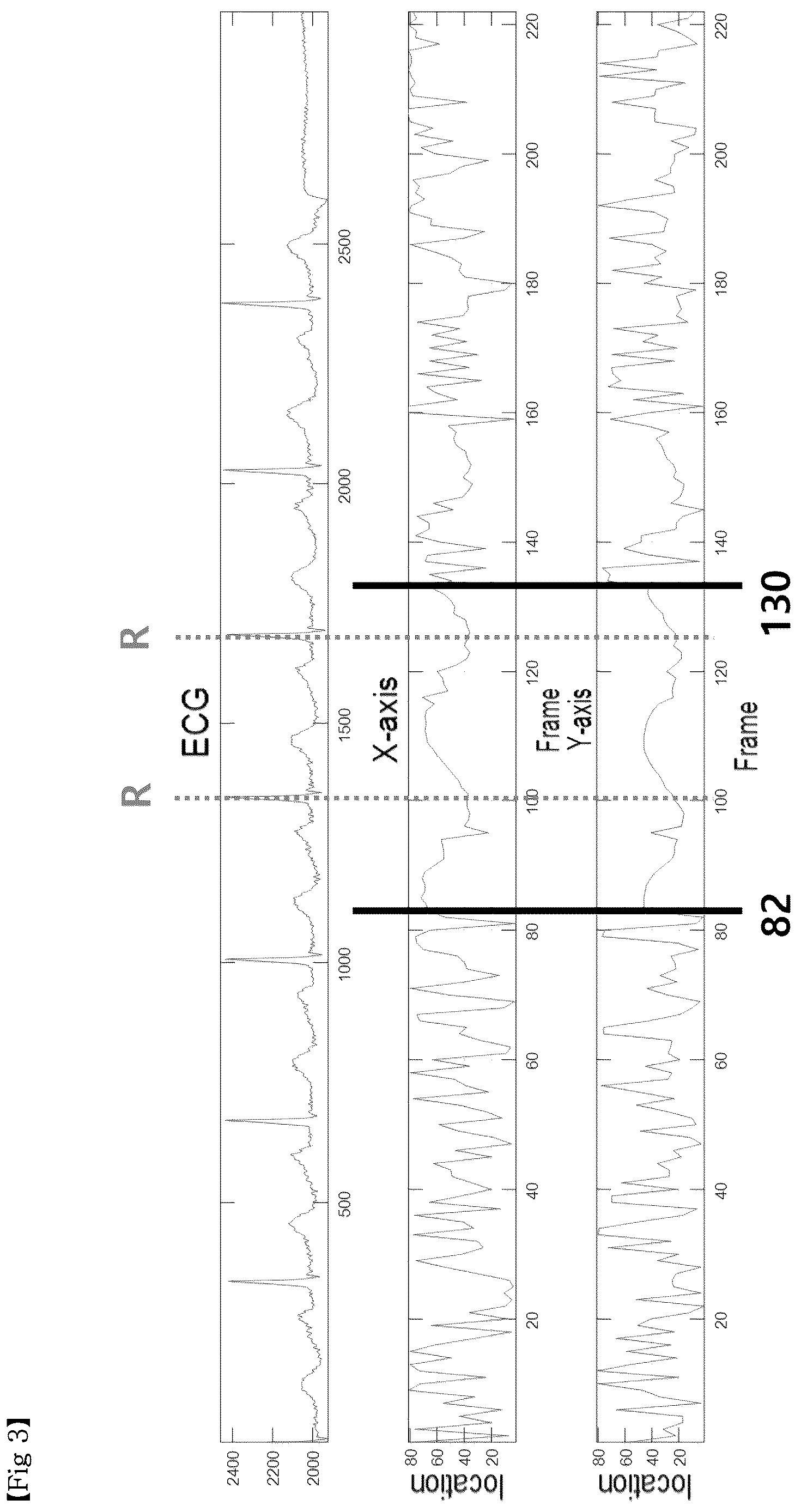 Patent US12611155 Figure 3 – Method for providing information necessary for evaluating severity of coronary artery stenosis