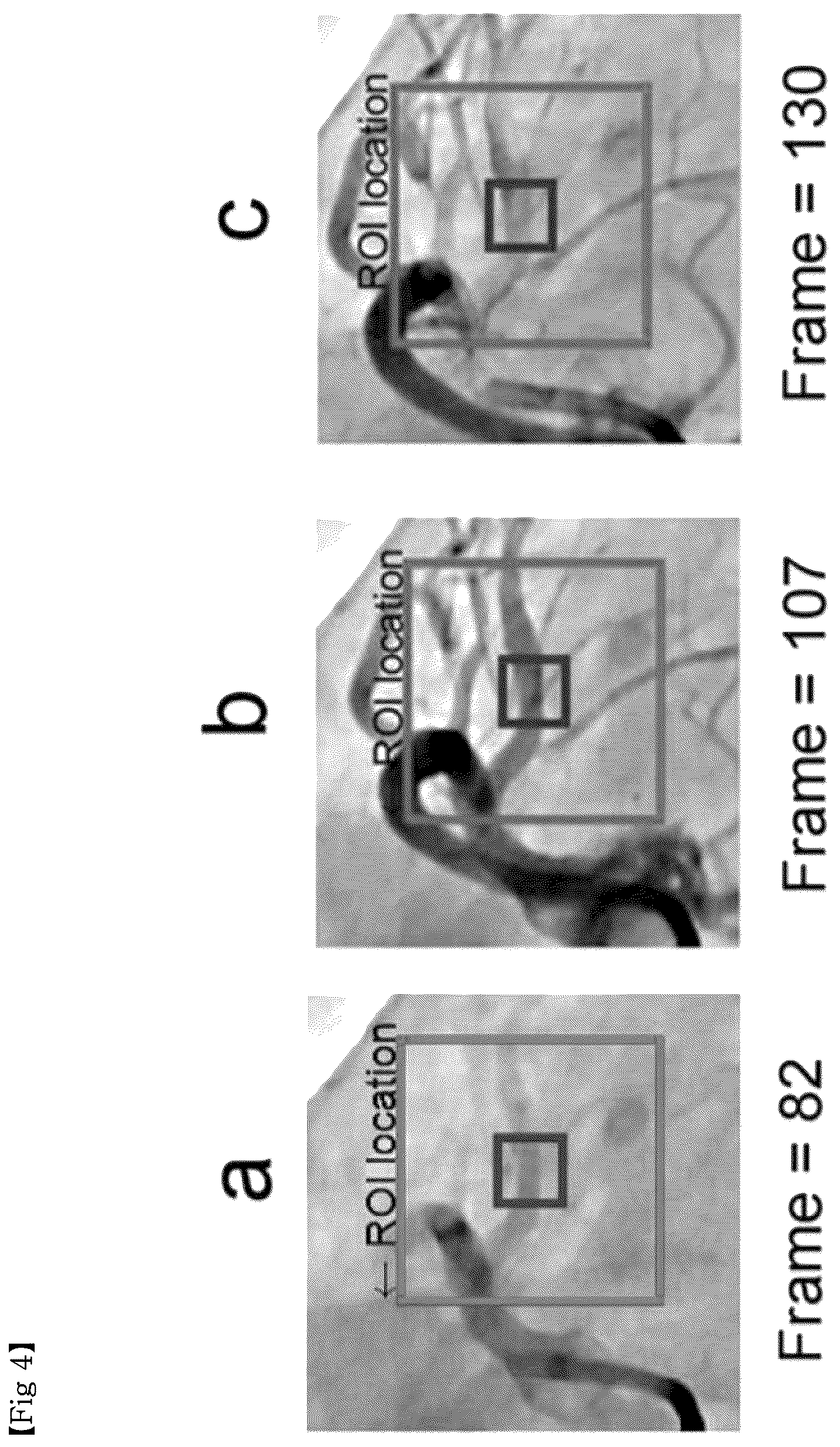 Patent US12611155 Figure 4 – Method for providing information necessary for evaluating severity of coronary artery stenosis