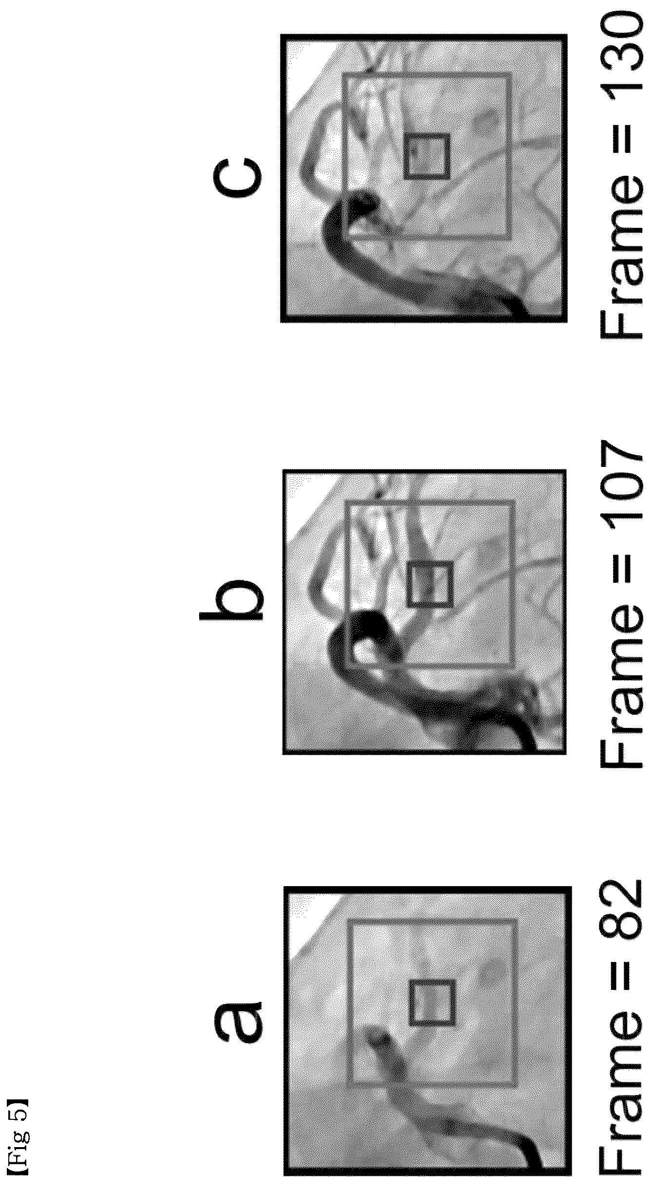 Patent US12611155 Figure 5 – Method for providing information necessary for evaluating severity of coronary artery stenosis