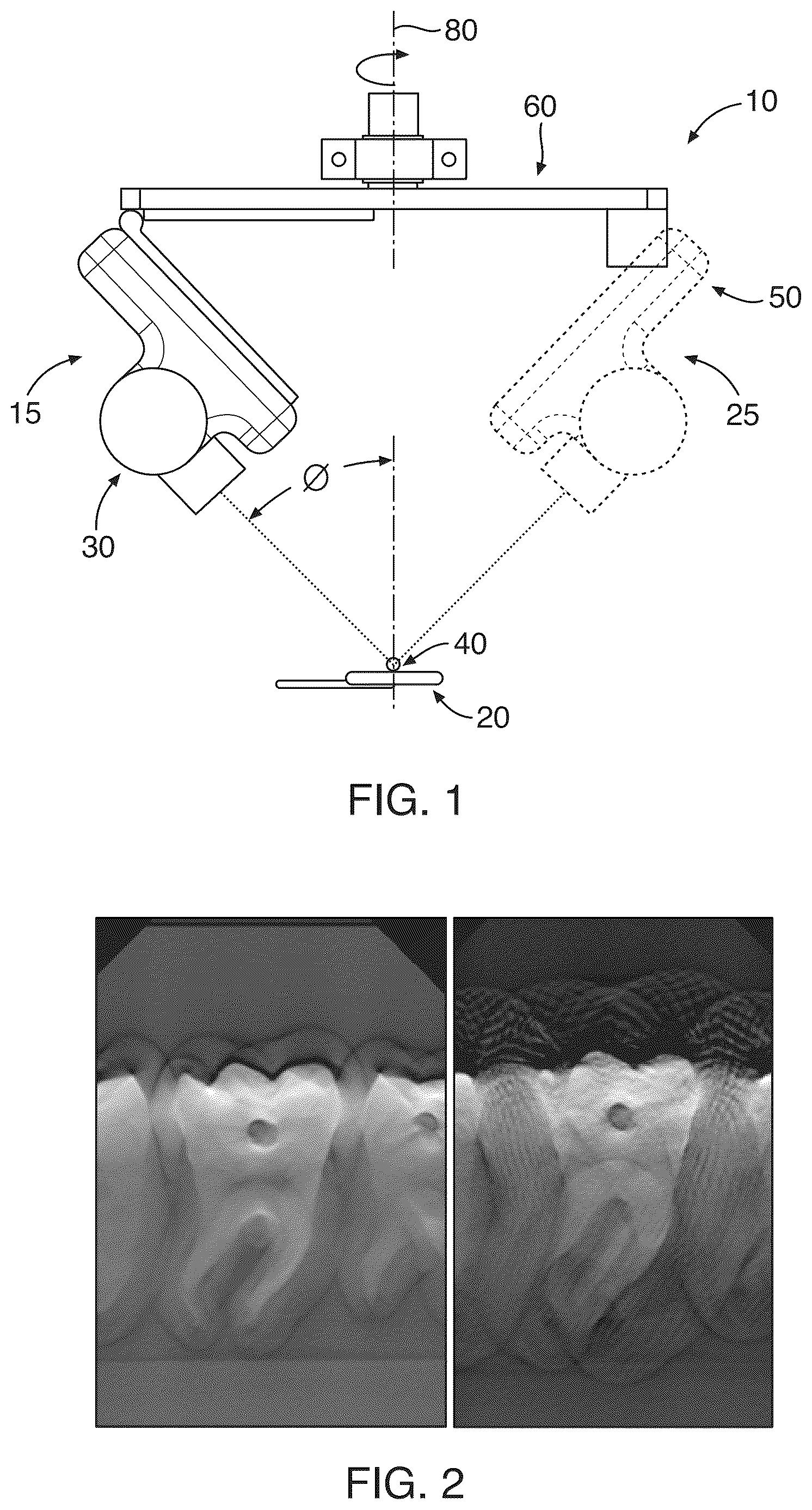Patent US12611156 Figure 1 – Three dimensional x-ray imaging system
