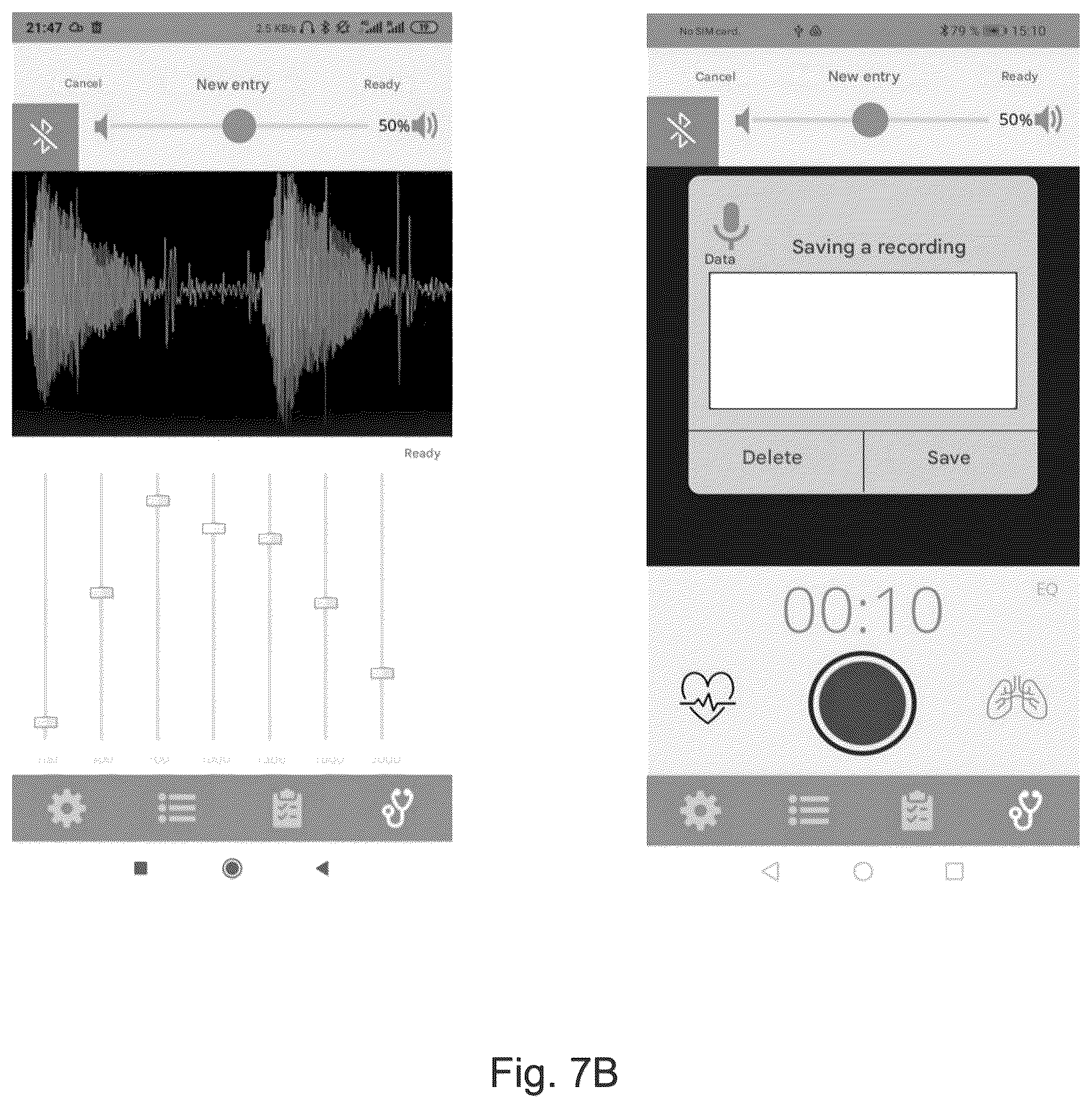 Patent US12611159 Figure 8 – Digital stethoscope