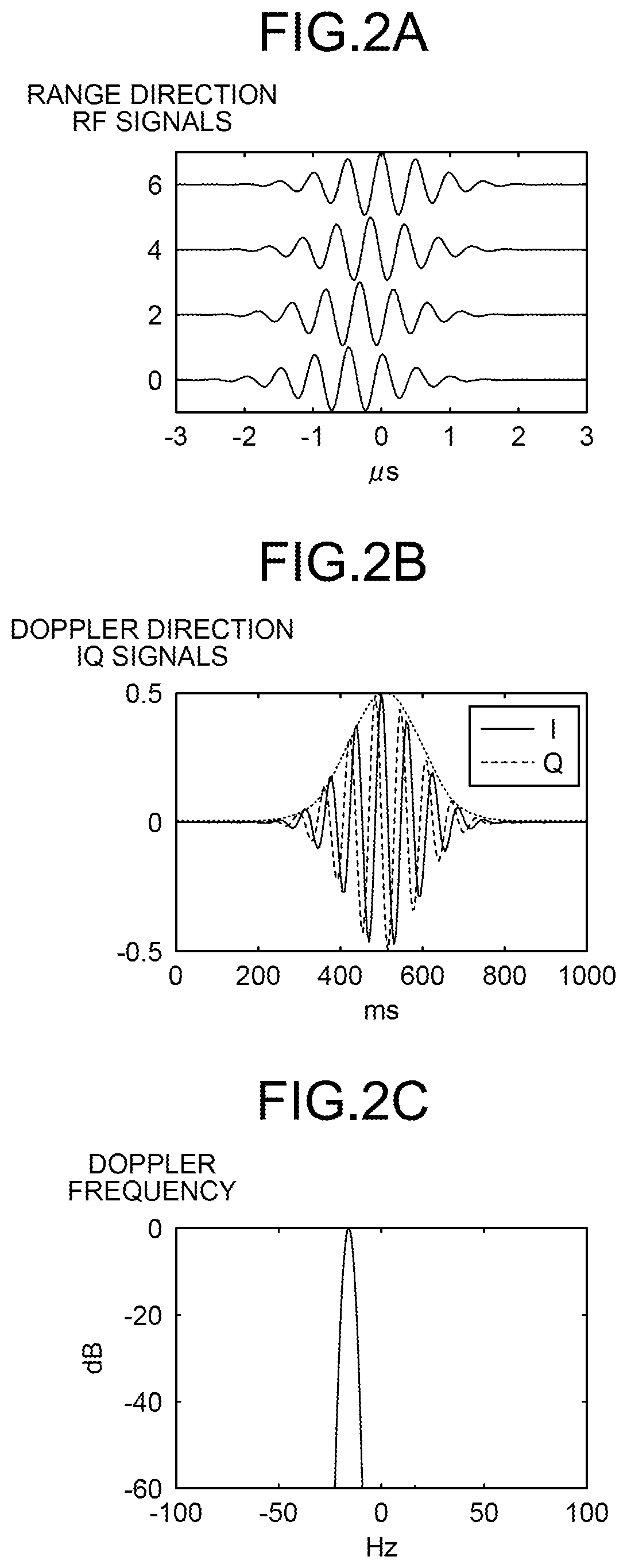 Patent US12611160 Figure 2 – Ultrasonic diagnostic device and image processing device