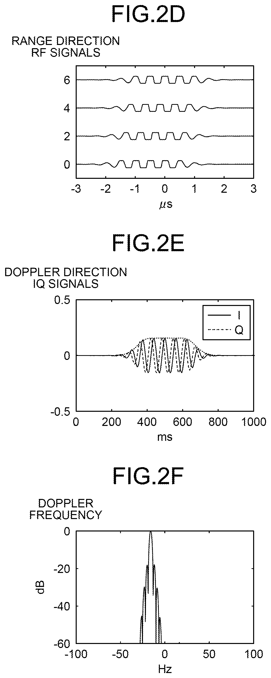 Patent US12611160 Figure 3 – Ultrasonic diagnostic device and image processing device