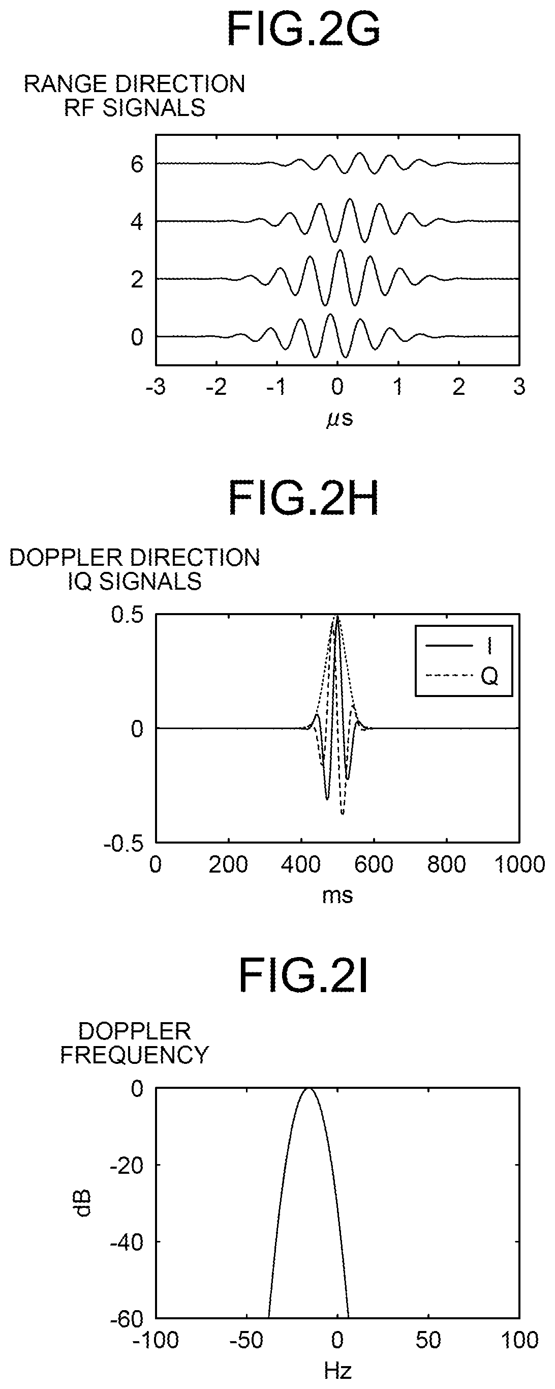Patent US12611160 Figure 4 – Ultrasonic diagnostic device and image processing device