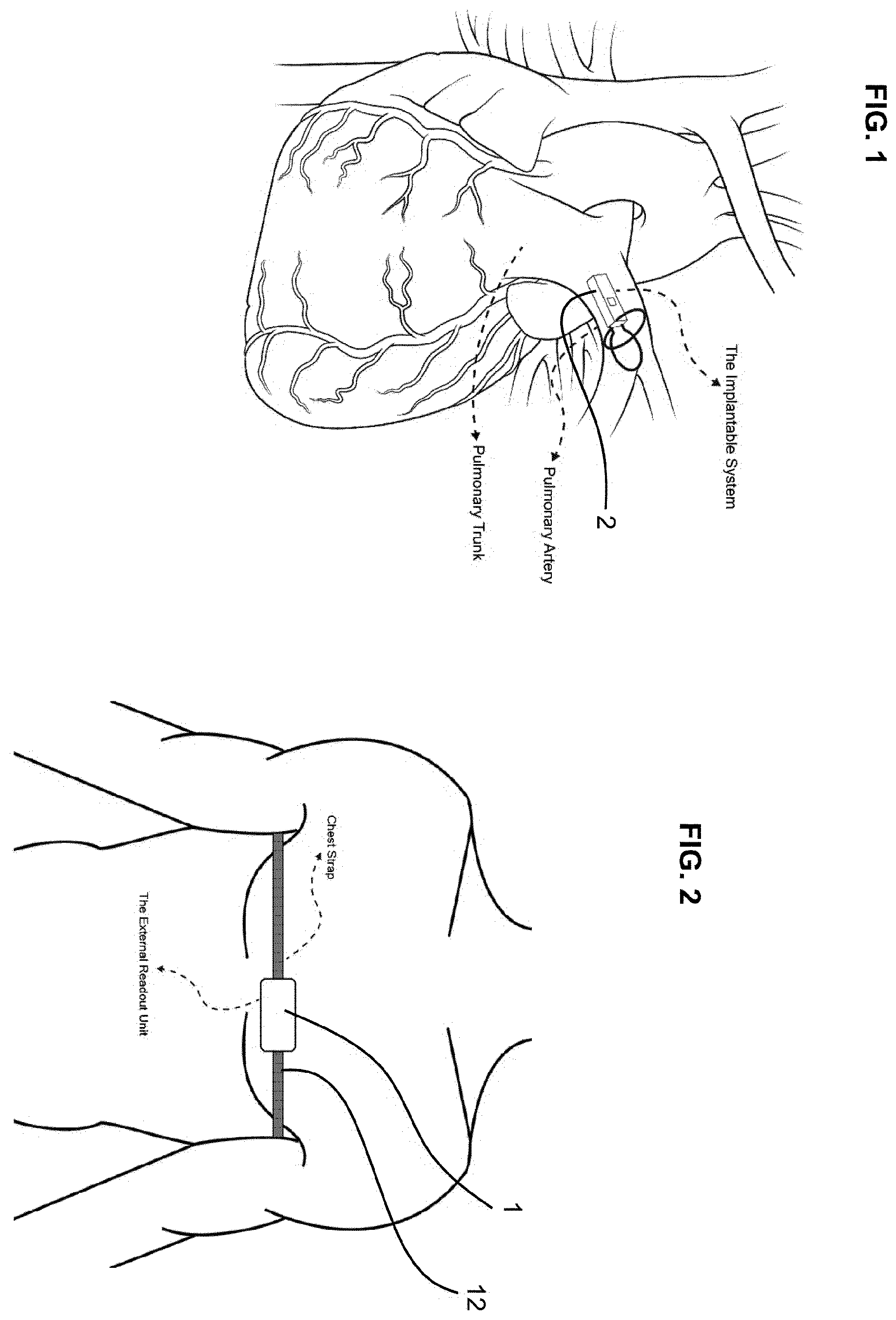 Patent US12611161 Figure 1 – Cardiovascular monitoring system