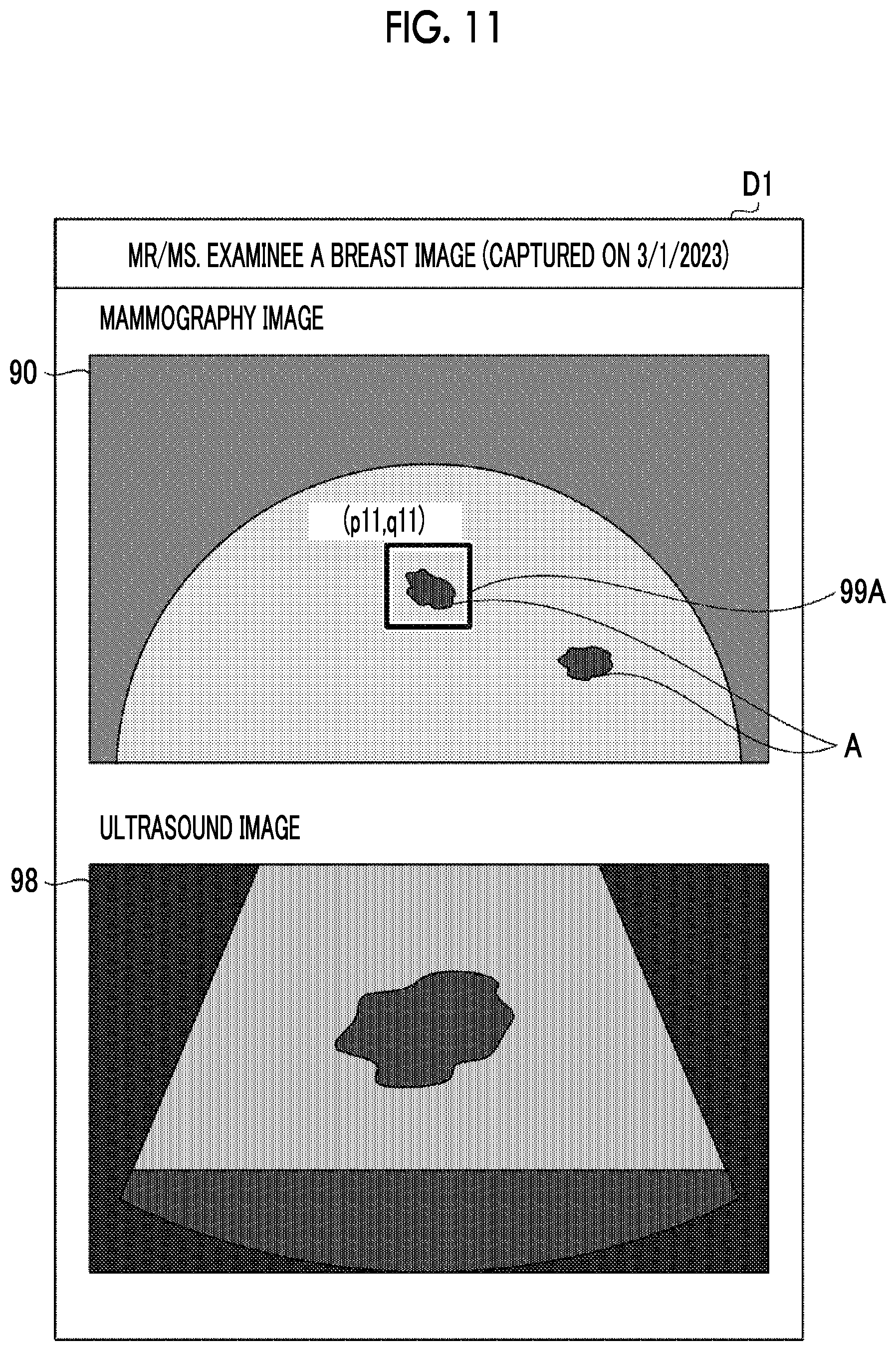 Patent US12611162 Figure 7 – Imaging apparatus and imaging system having drive device for moving ultrasound unit, and method of imaging ultrasound image with moving ultrasound unit
