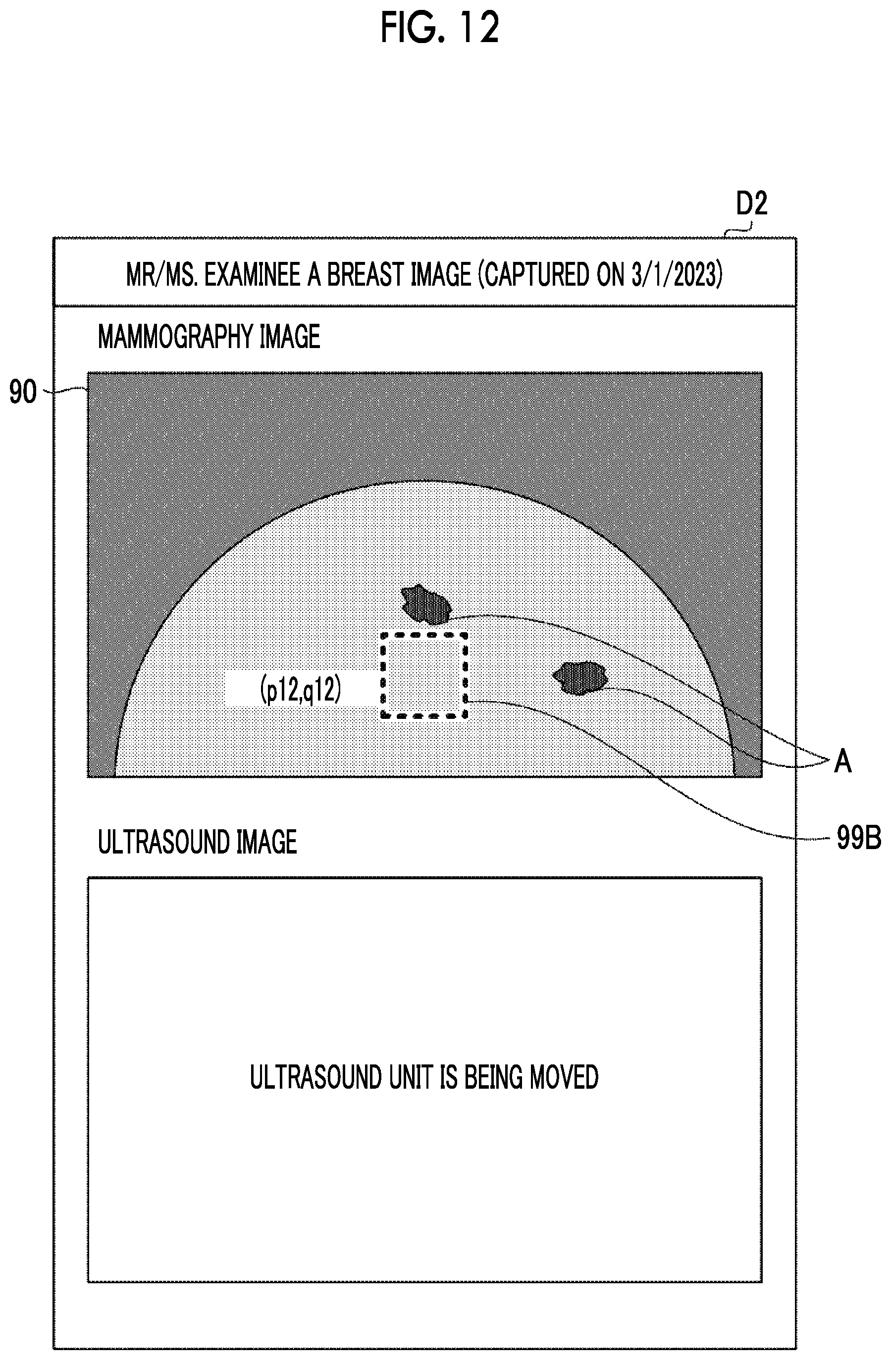 Patent US12611162 Figure 8 – Imaging apparatus and imaging system having drive device for moving ultrasound unit, and method of imaging ultrasound image with moving ultrasound unit
