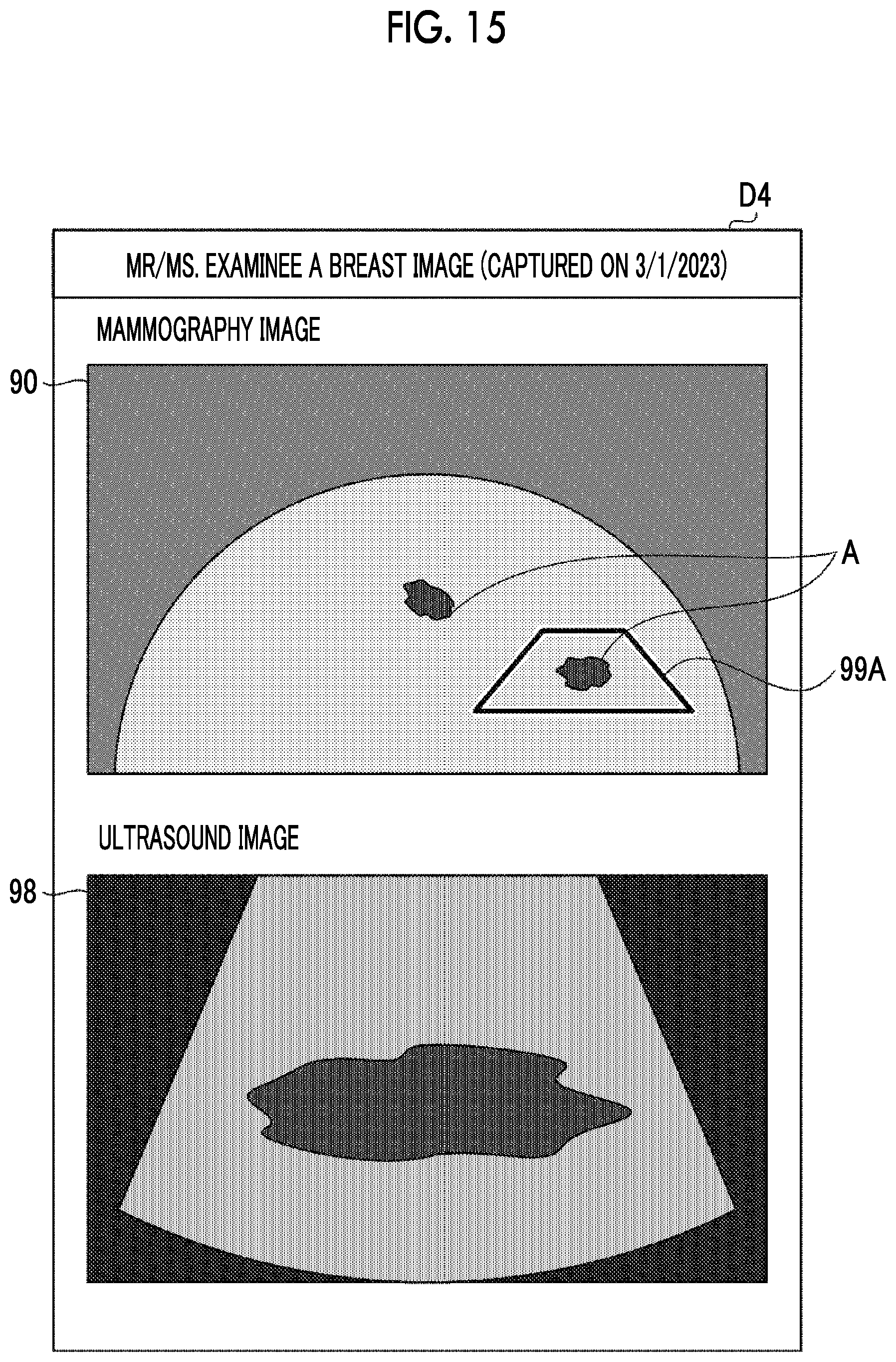 Patent US12611162 Figure 11 – Imaging apparatus and imaging system having drive device for moving ultrasound unit, and method of imaging ultrasound image with moving ultrasound unit