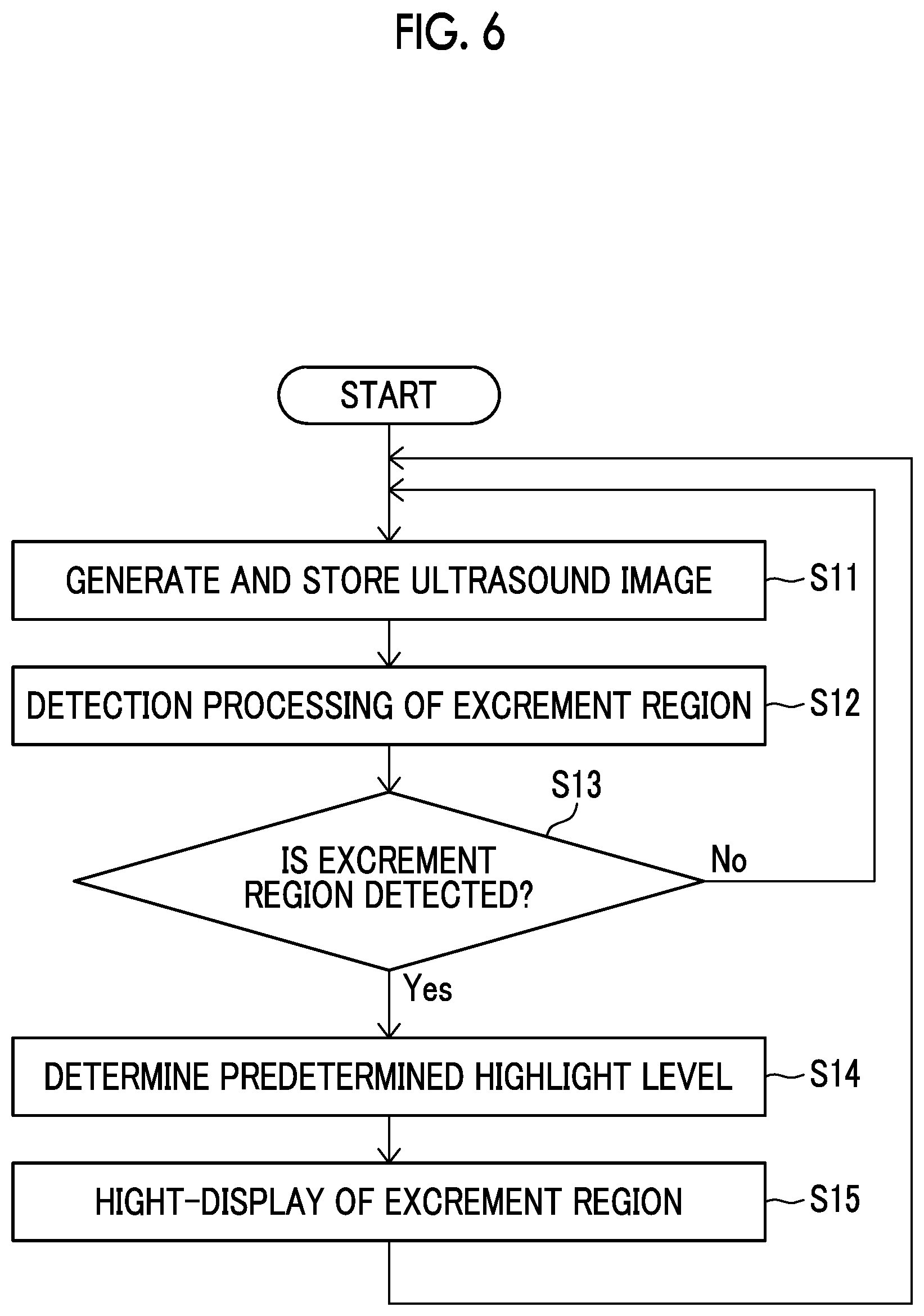 Patent US12611164 Figure 5 – Ultrasound diagnostic apparatus with function for highlight-displaying excrement region in ultrasound image and control method for ultrasound diagnostic apparatus
