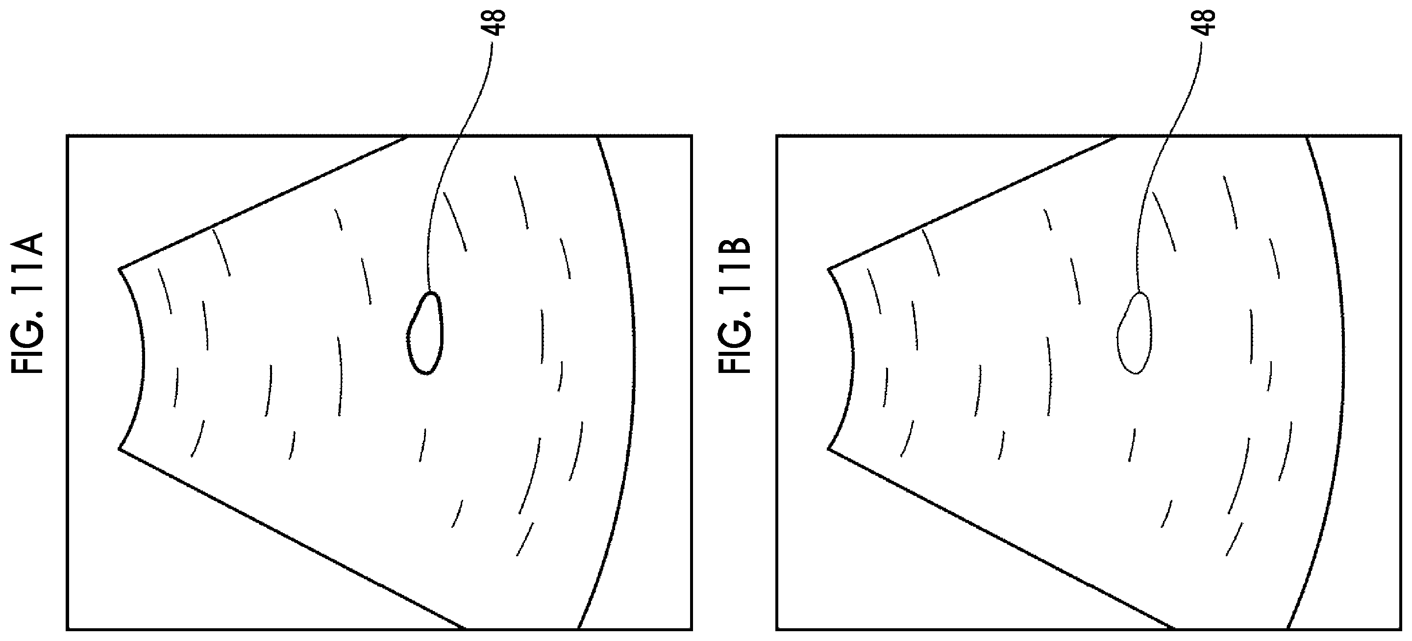 Patent US12611164 Figure 10 – Ultrasound diagnostic apparatus with function for highlight-displaying excrement region in ultrasound image and control method for ultrasound diagnostic apparatus