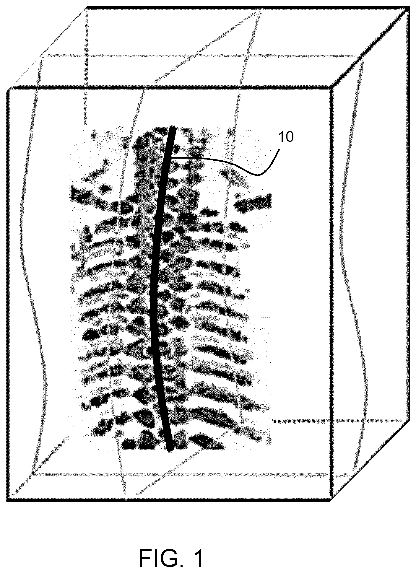 Patent US12611165 Figure 1 – Fetal ultrasound image processing