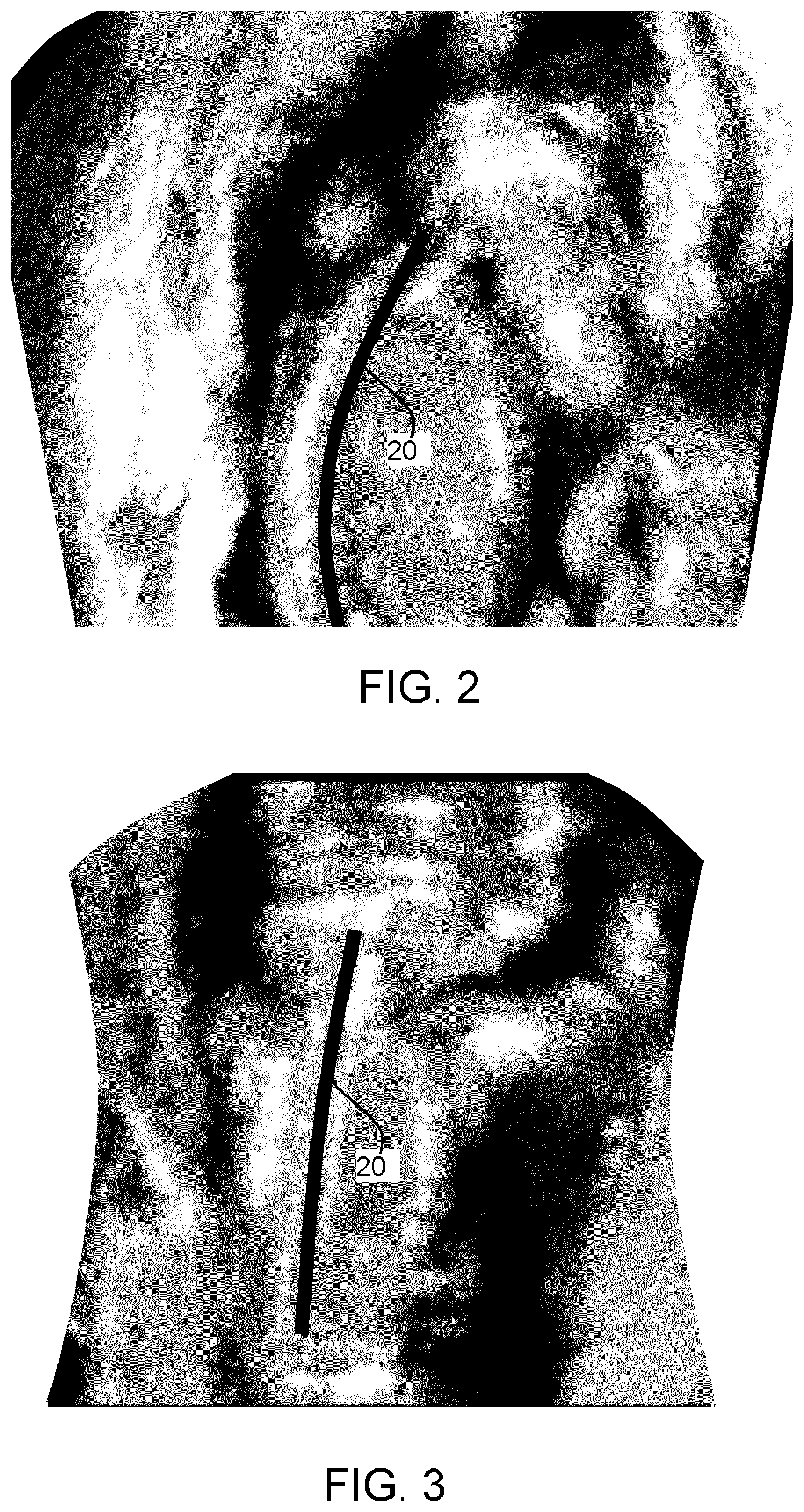 Patent US12611165 Figure 2 – Fetal ultrasound image processing
